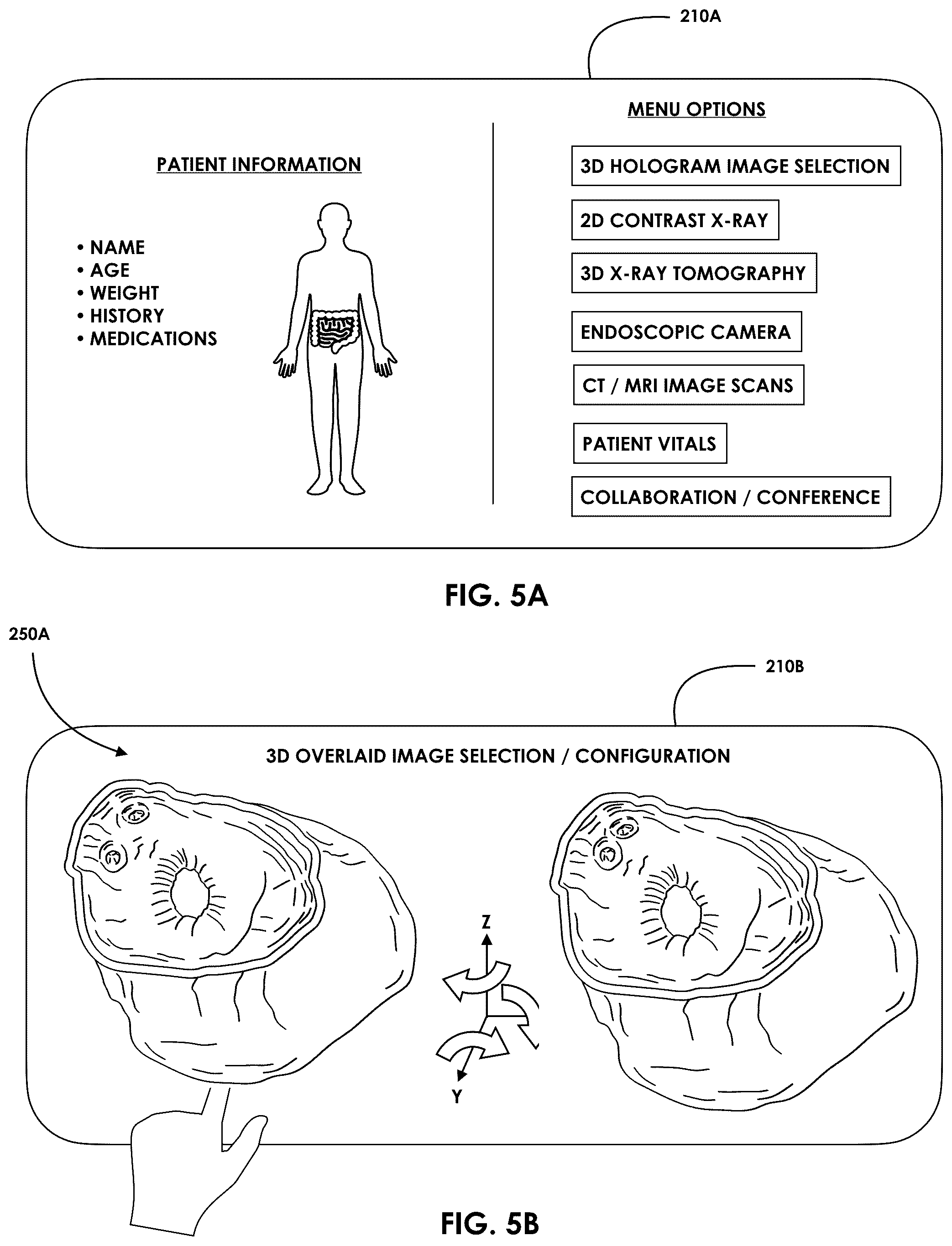 Patent US12599457 Figure 5 – Mixed reality endoscopic retrograde cholangiopancreatopgraphy (ERCP) procedure