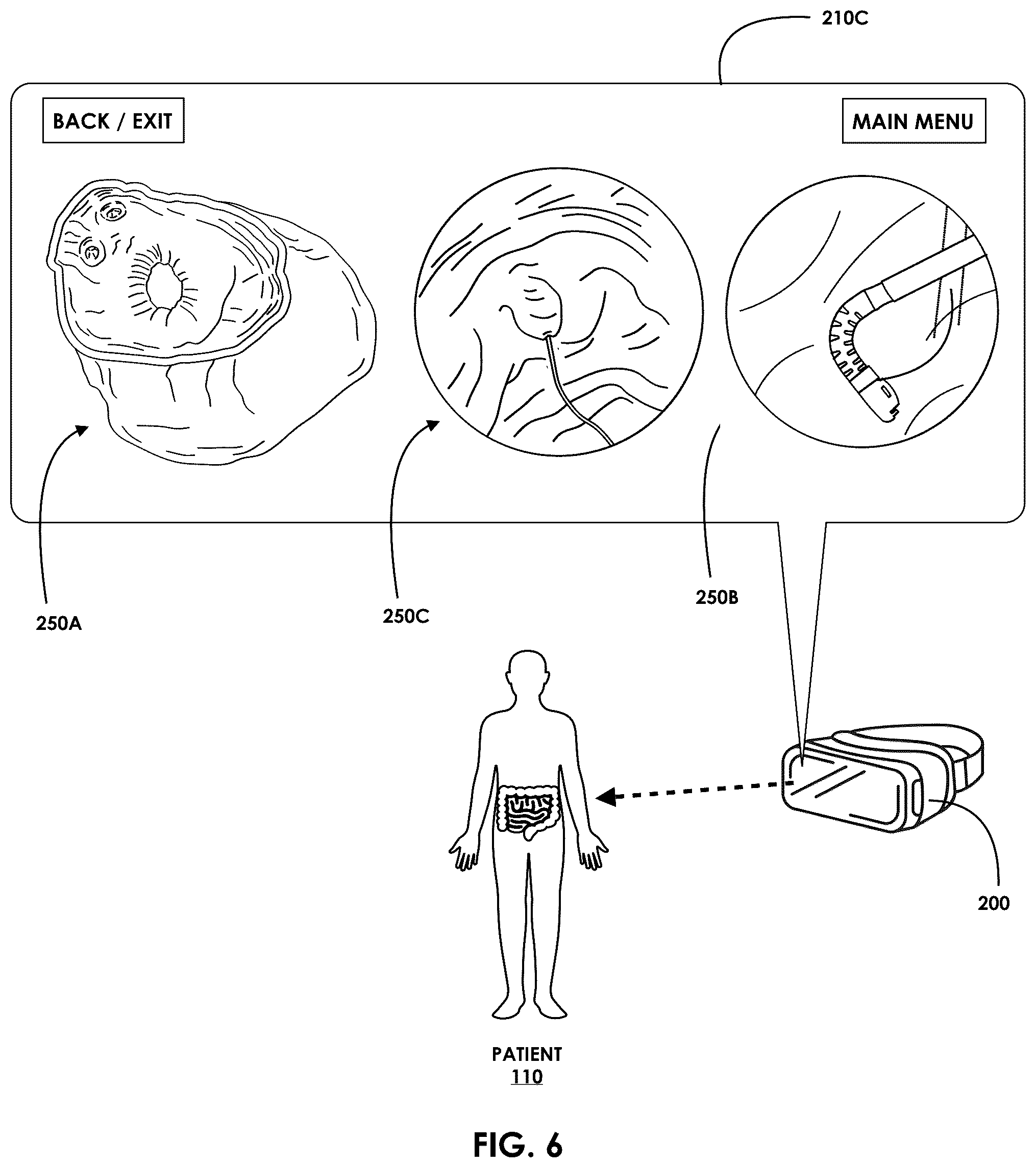 Patent US12599457 Figure 6 – Mixed reality endoscopic retrograde cholangiopancreatopgraphy (ERCP) procedure