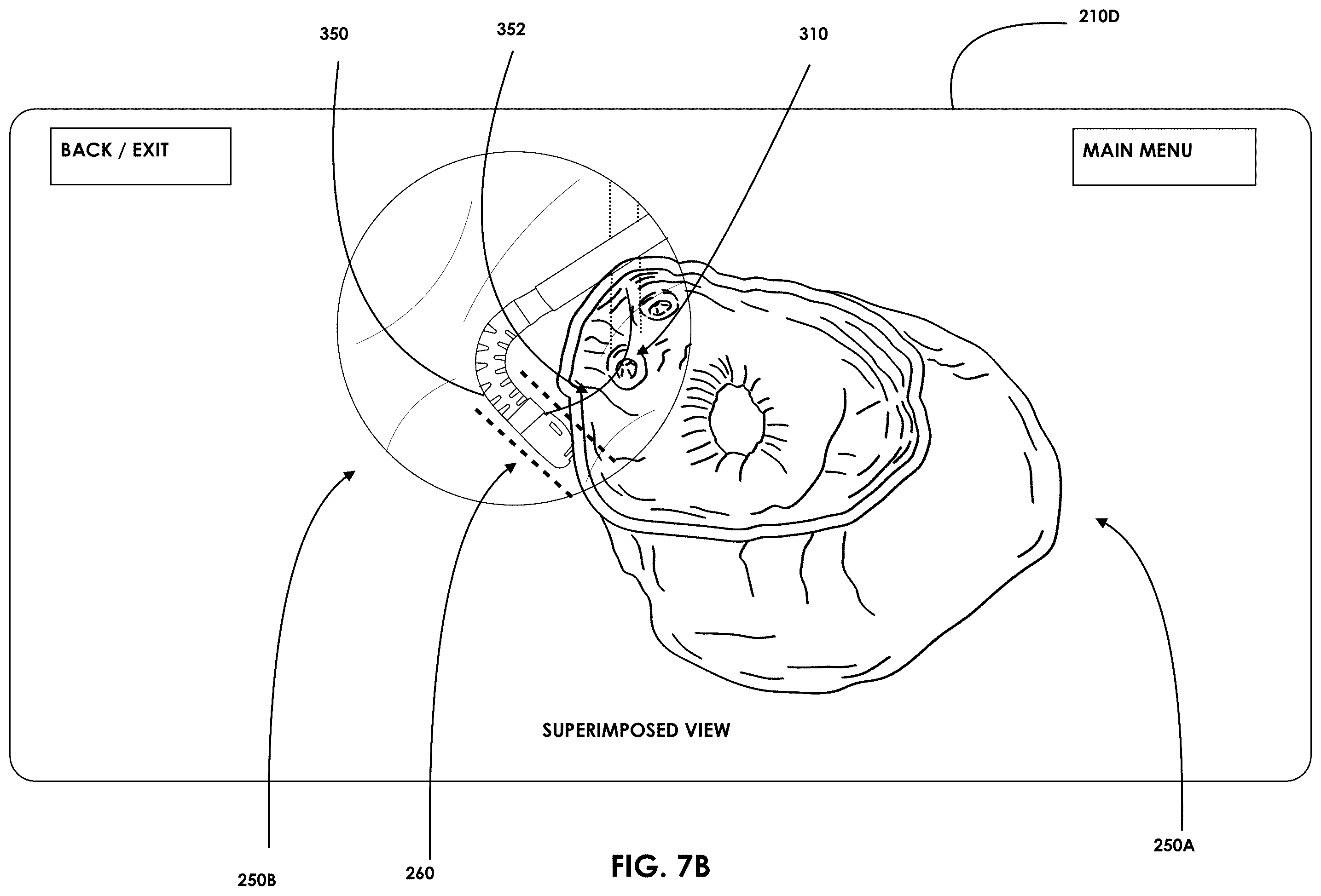 Patent US12599457 Figure 8 – Mixed reality endoscopic retrograde cholangiopancreatopgraphy (ERCP) procedure