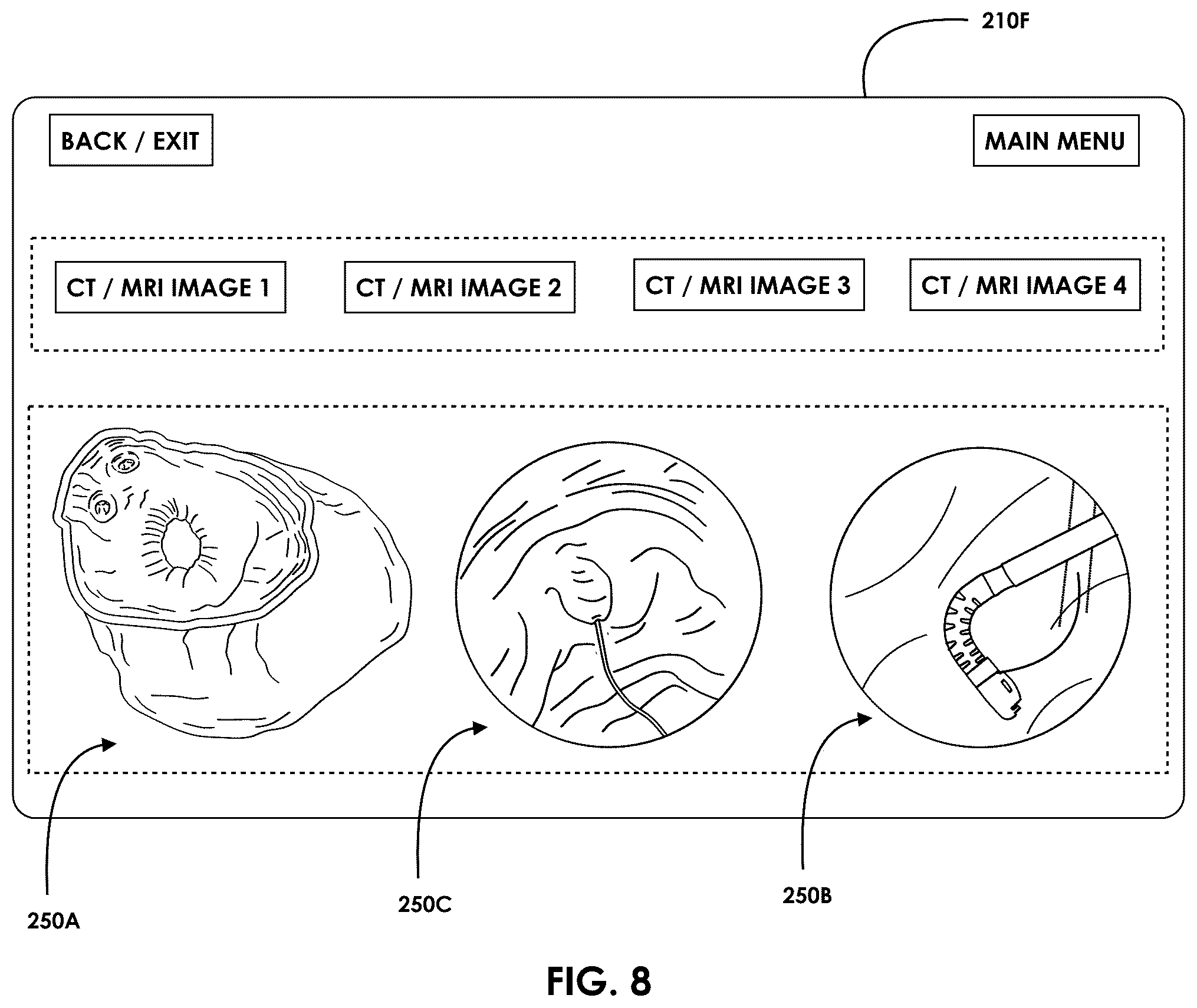 Patent US12599457 Figure 9 – Mixed reality endoscopic retrograde cholangiopancreatopgraphy (ERCP) procedure
