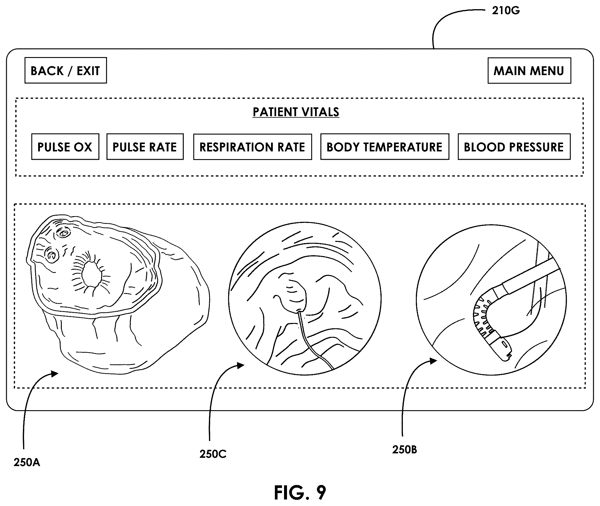 Patent US12599457 Figure 10 – Mixed reality endoscopic retrograde cholangiopancreatopgraphy (ERCP) procedure