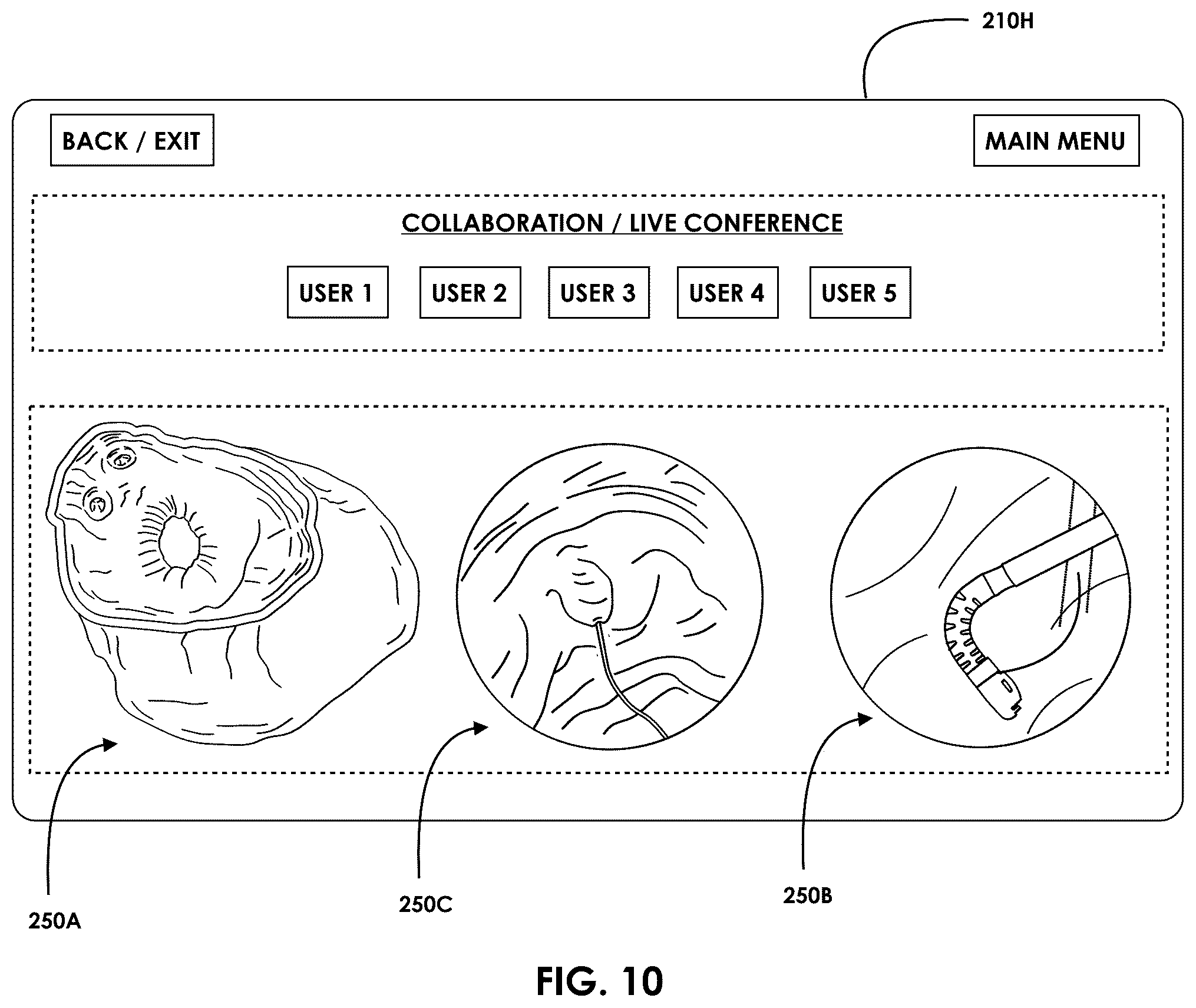 Patent US12599457 Figure 11 – Mixed reality endoscopic retrograde cholangiopancreatopgraphy (ERCP) procedure