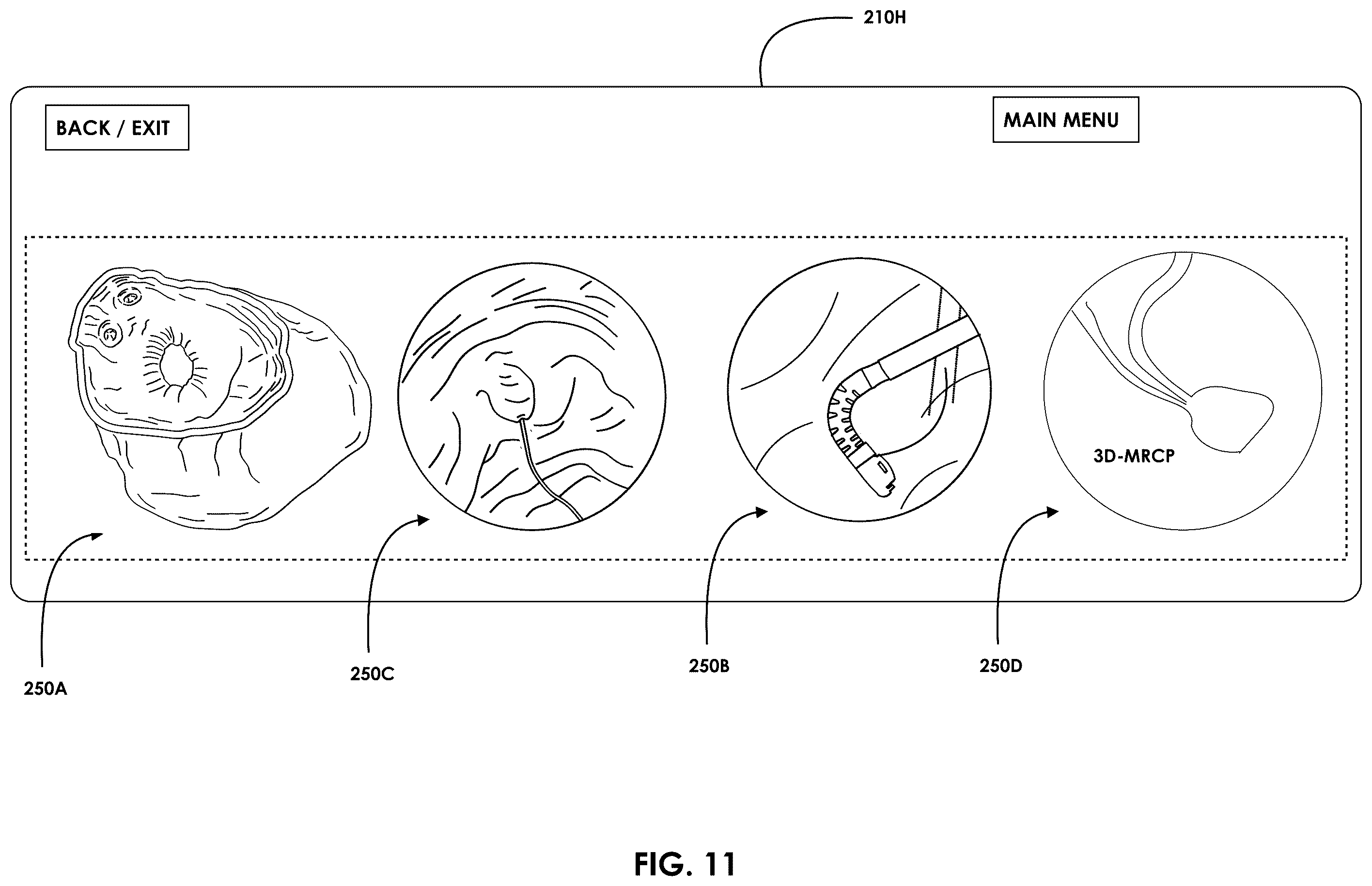 Patent US12599457 Figure 12 – Mixed reality endoscopic retrograde cholangiopancreatopgraphy (ERCP) procedure