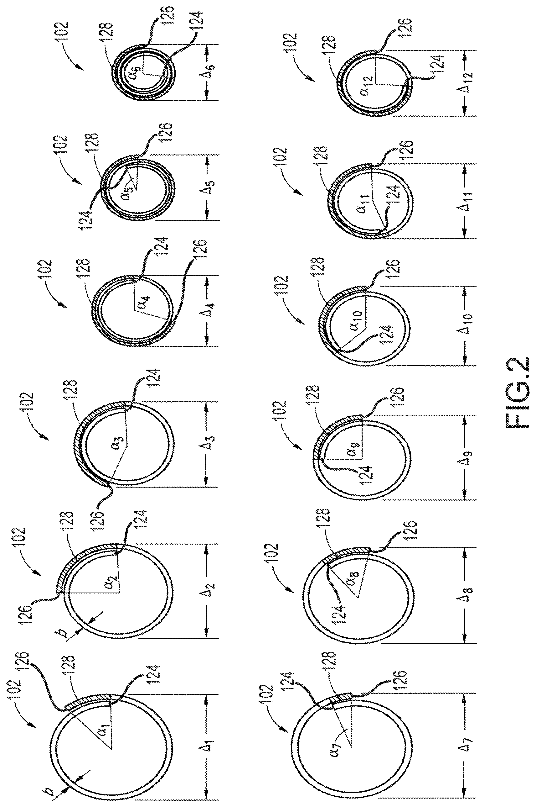 Patent US12599458 Figure 2 – Vascular device marker attachment
