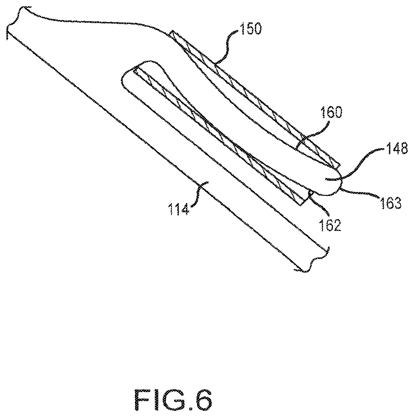 Patent US12599458 Figure 6 – Vascular device marker attachment