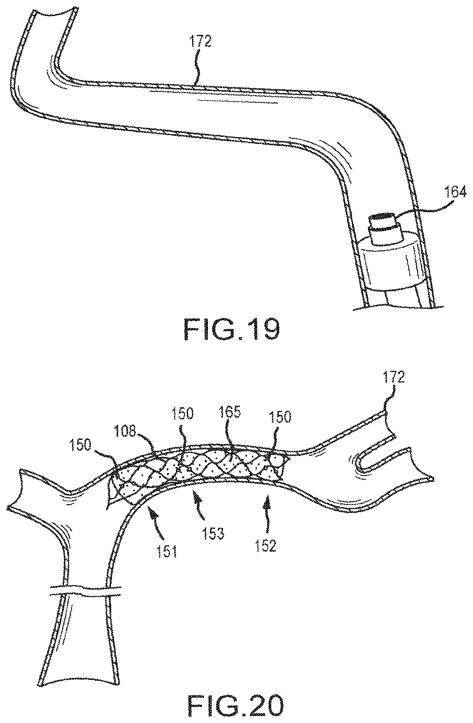 Patent US12599458 Figure 14 – Vascular device marker attachment