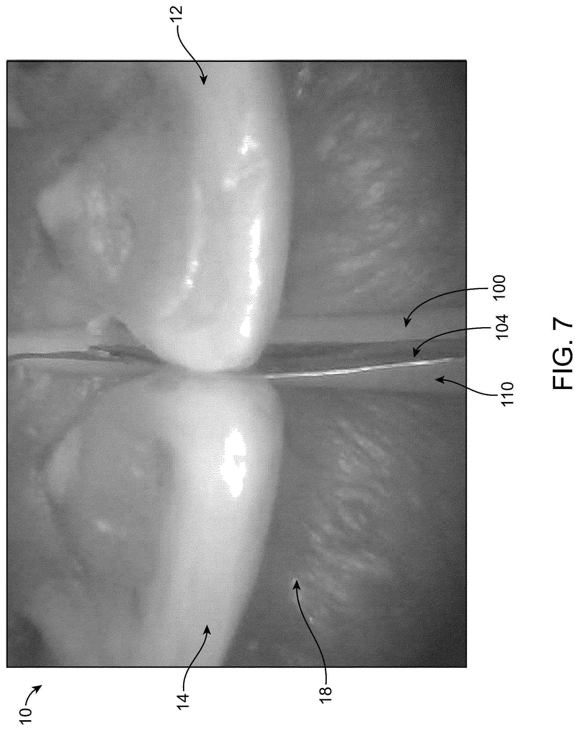 Patent US12599460 Figure 10 – Device for placement in interdental resin fillings
