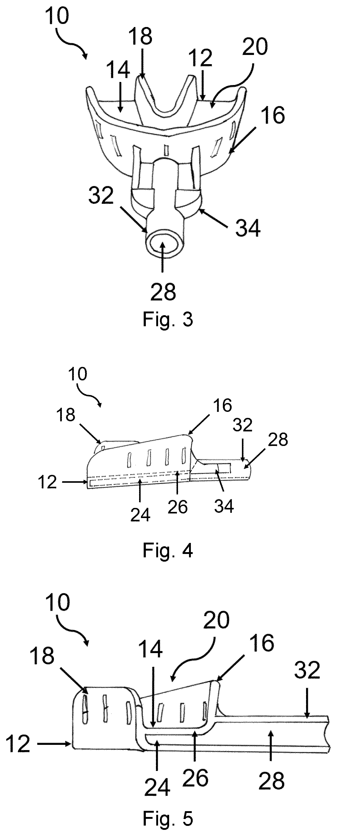 Patent US12599461 Figure 2 – Impression tray
