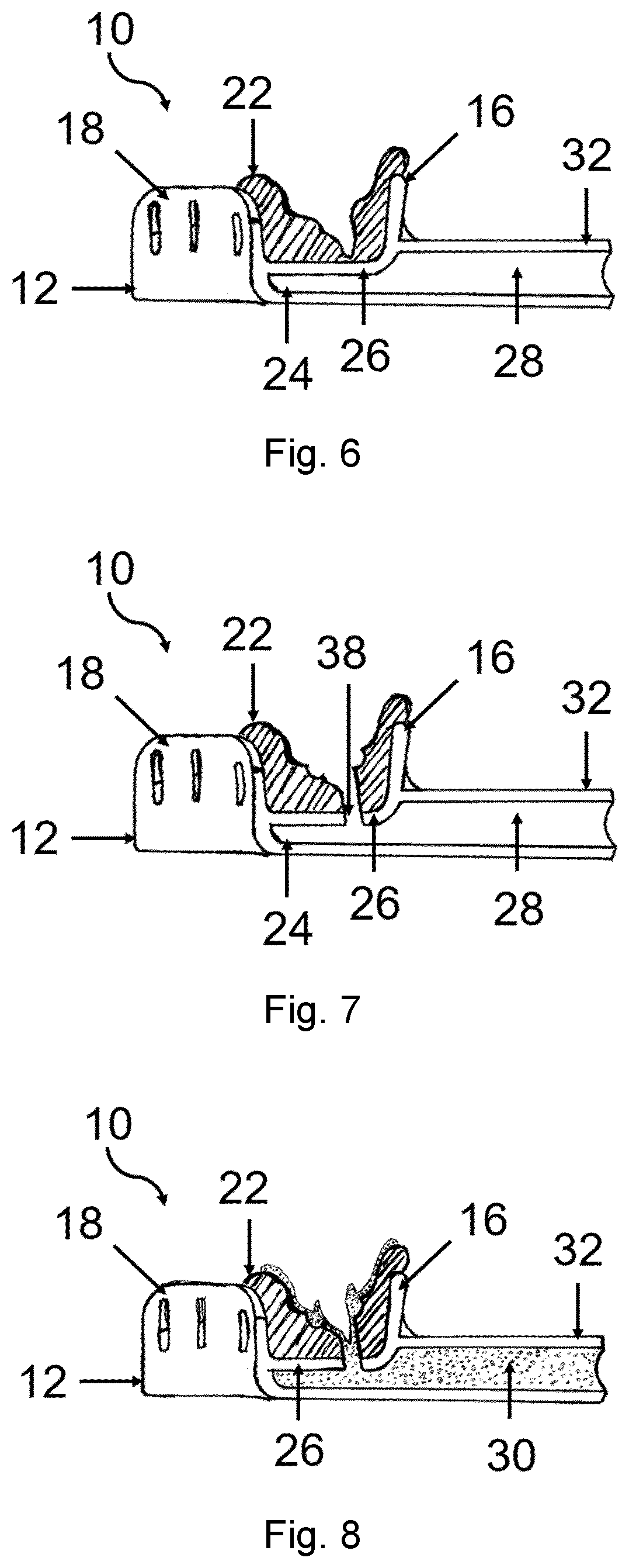 Patent US12599461 Figure 3 – Impression tray