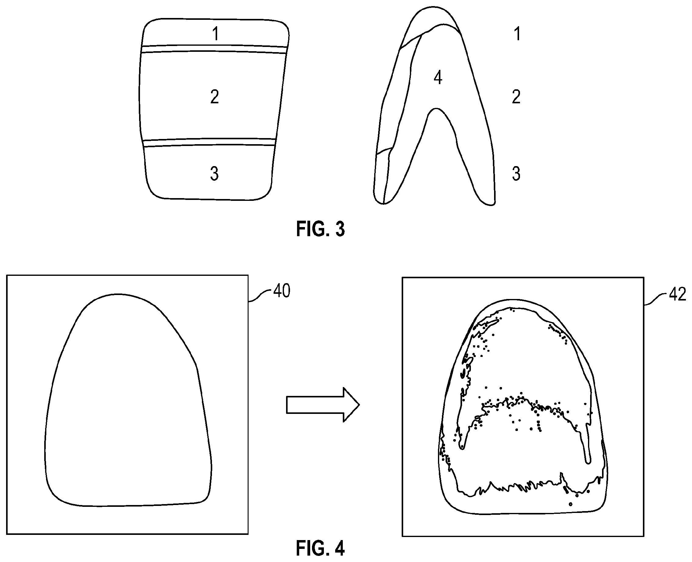 Patent US12599463 Figure 3 – Color management process for customized dental restorations