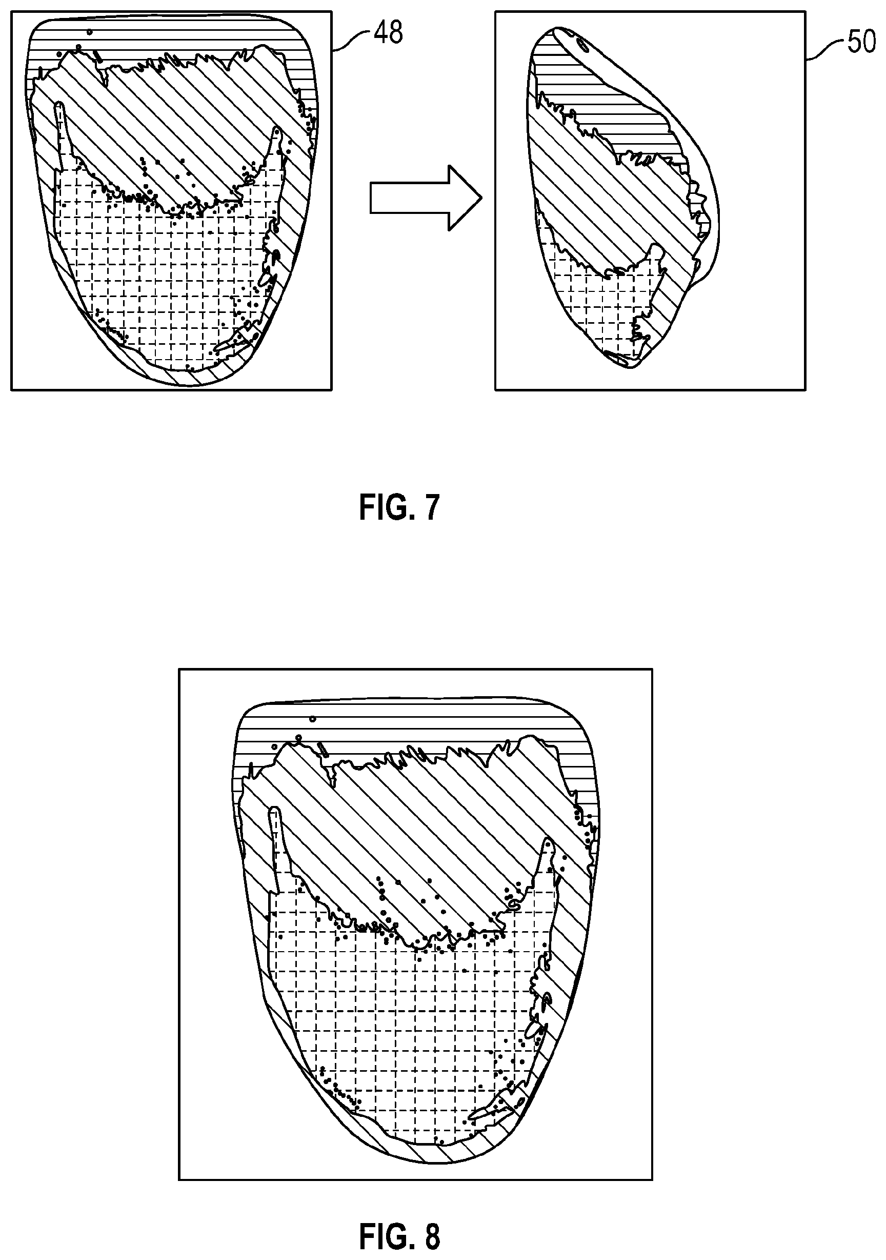 Patent US12599463 Figure 5 – Color management process for customized dental restorations