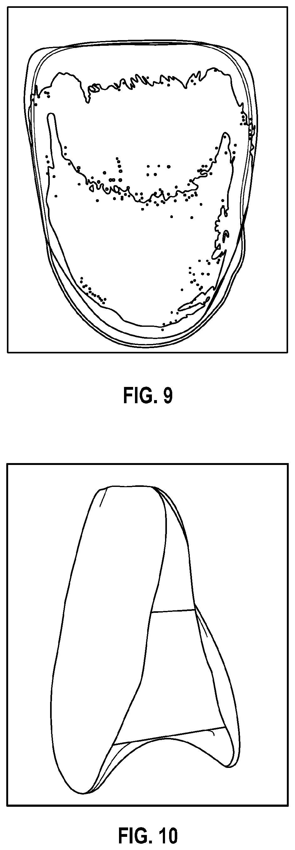 Patent US12599463 Figure 6 – Color management process for customized dental restorations