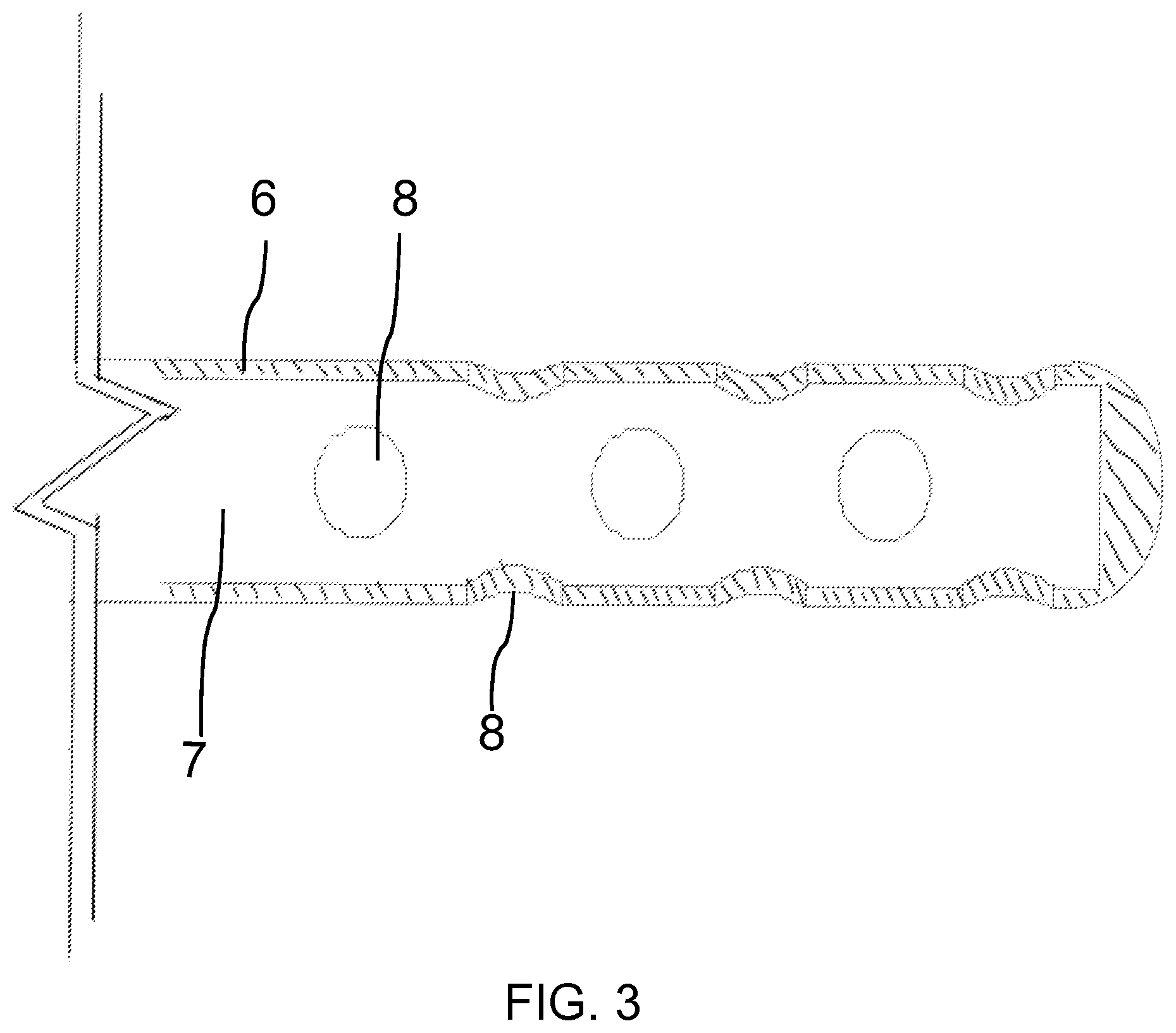 Patent US12599465 Figure 3 – Tooth root canal irrigation assembly for cleaning tooth root canals