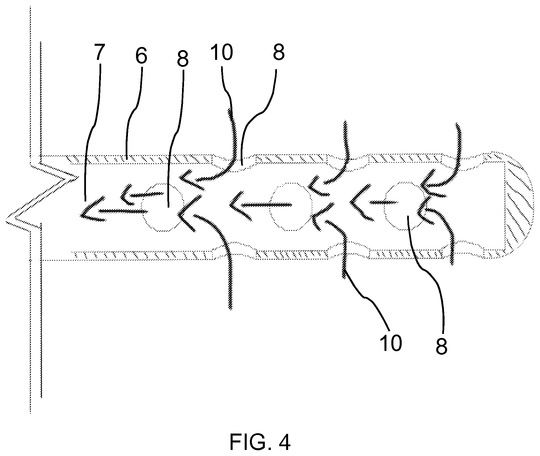 Patent US12599465 Figure 4 – Tooth root canal irrigation assembly for cleaning tooth root canals