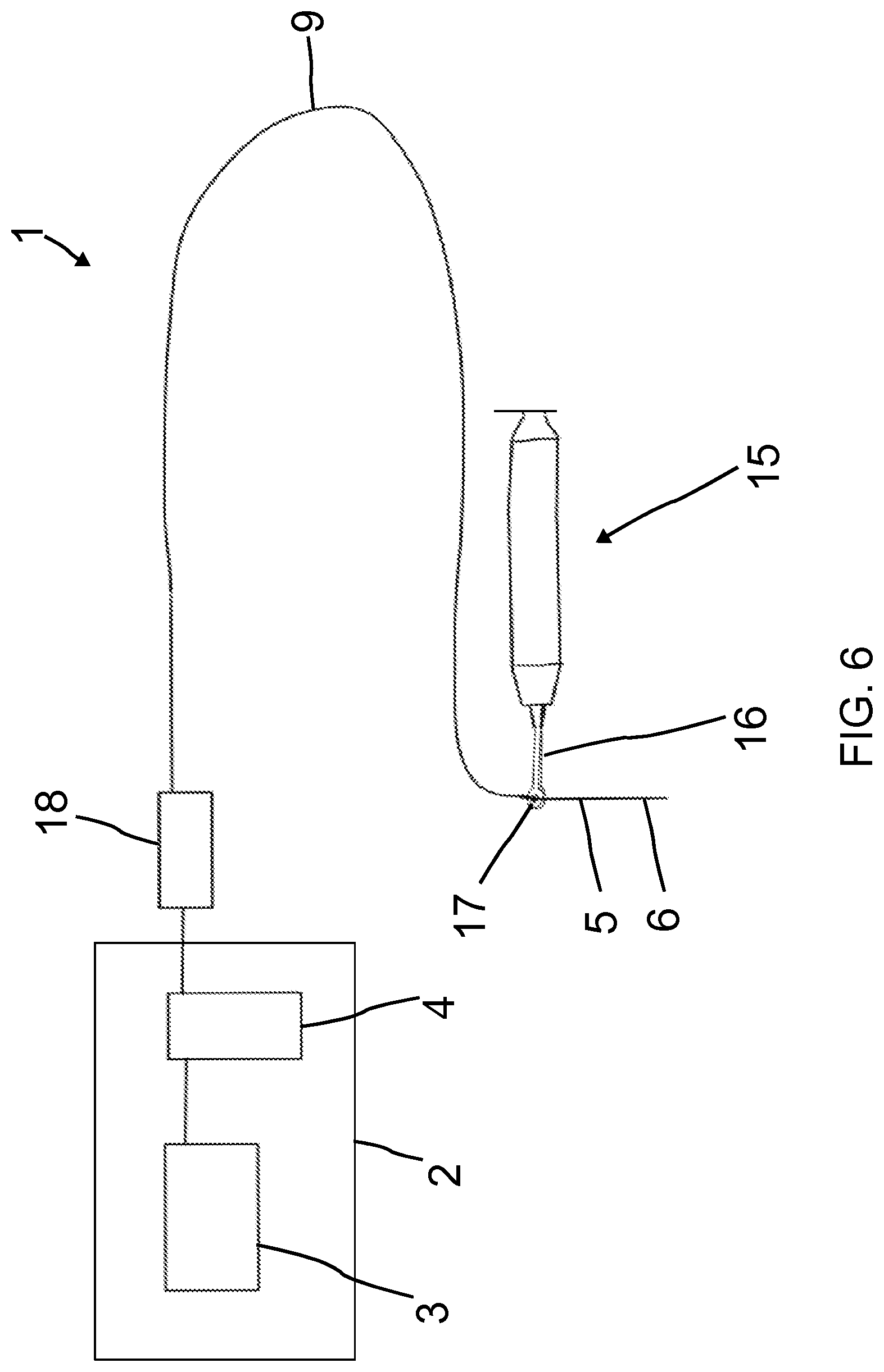 Patent US12599465 Figure 6 – Tooth root canal irrigation assembly for cleaning tooth root canals