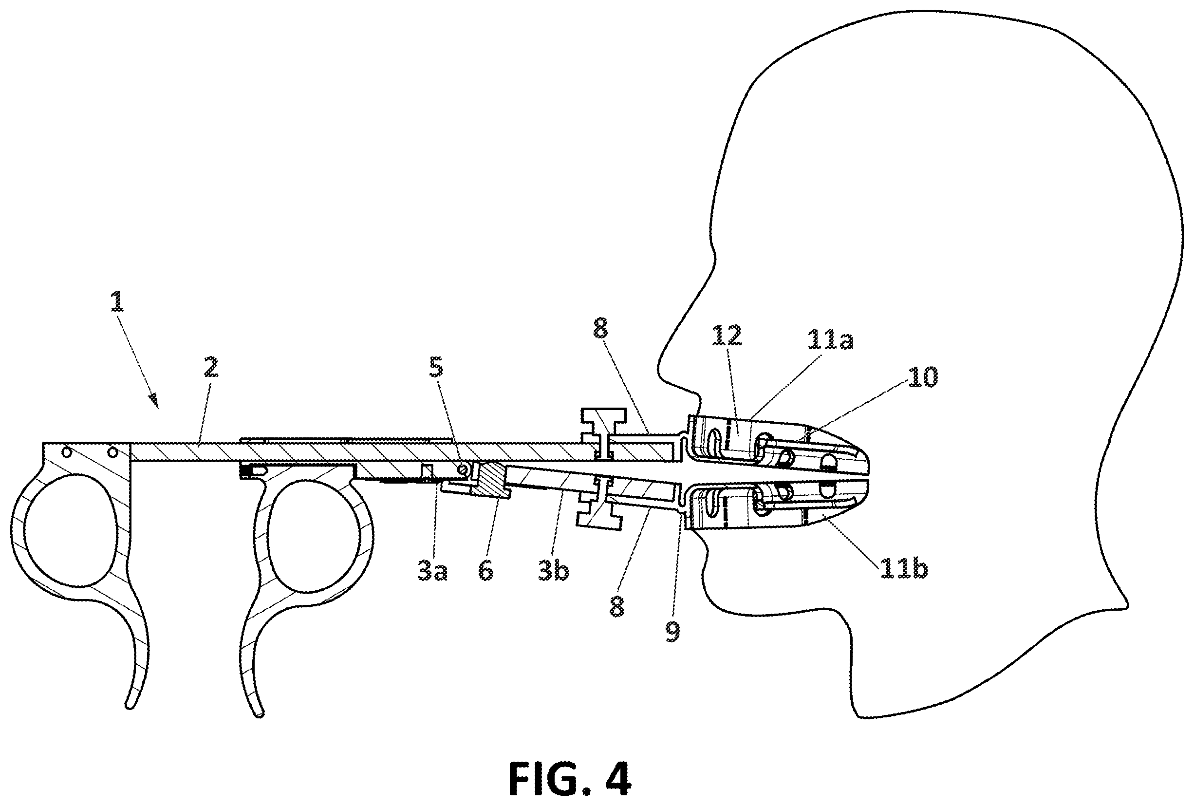 Patent US12599467 Figure 4 – Mandibular opening and advancement measurement and positioning device