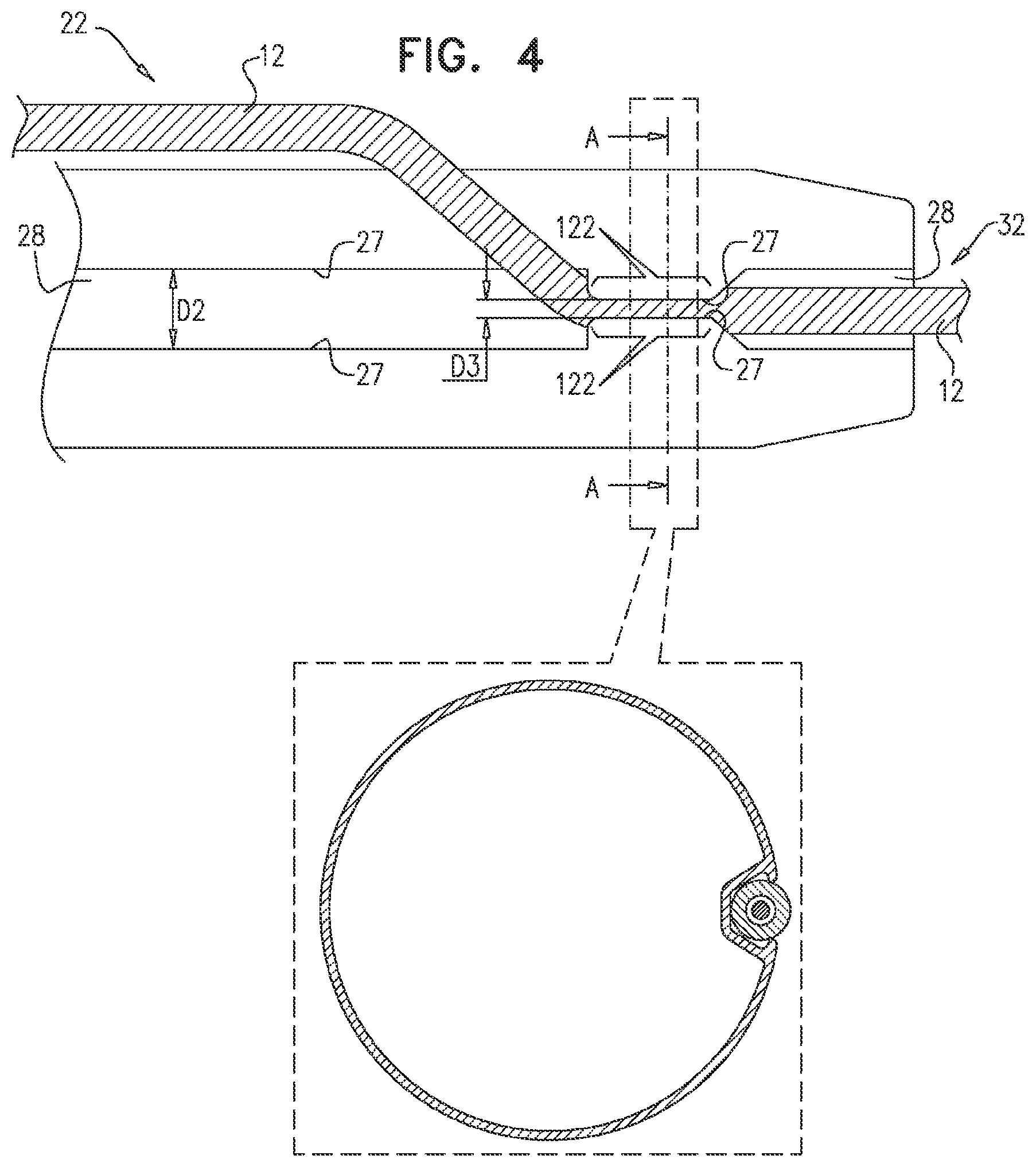 Patent US12599468 Figure 7 – Deployment of multiple biliary stents