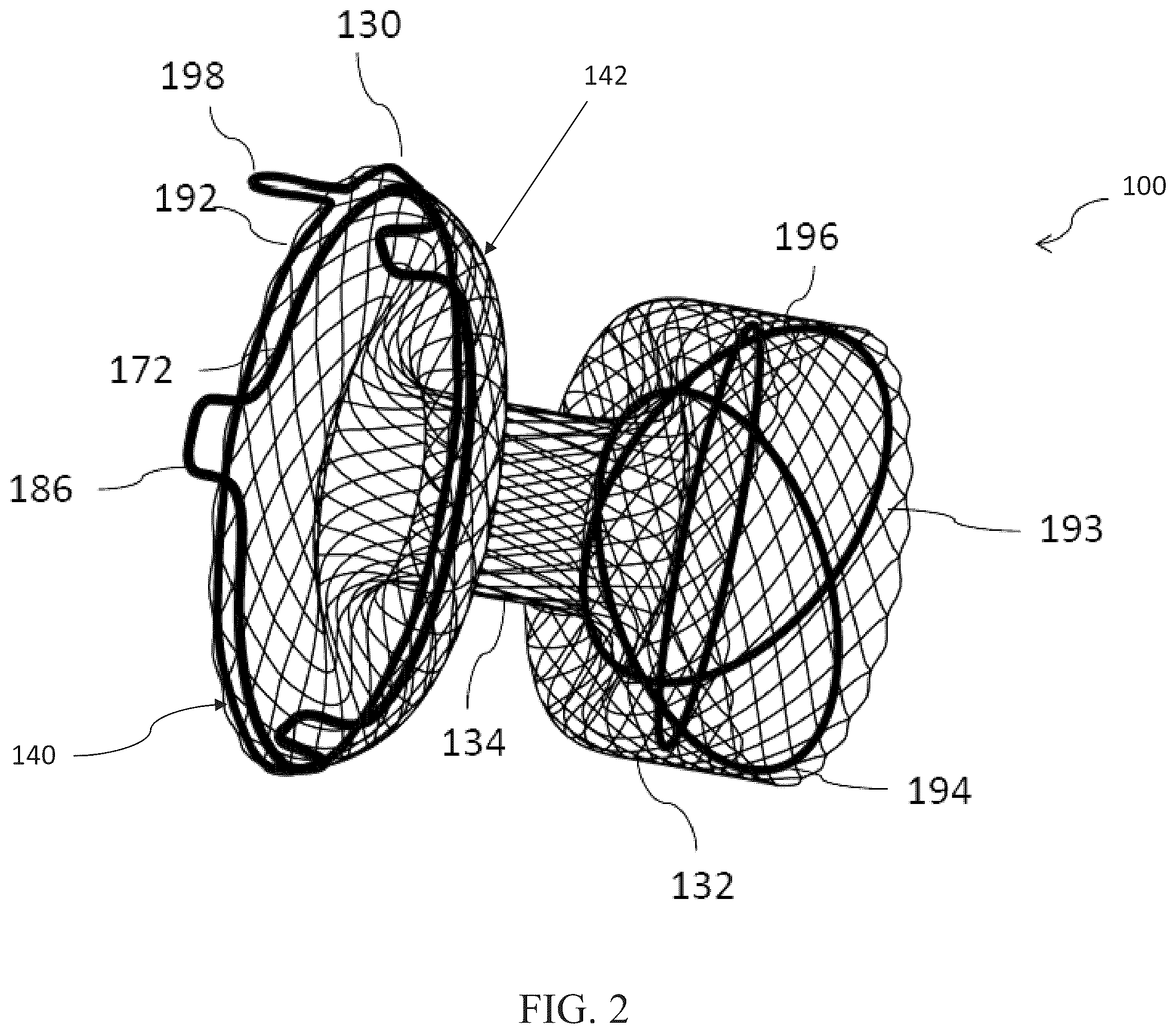 Patent US12599469 Figure 2 – Systems and methods for anchoring and restraining gastrointestinal prostheses