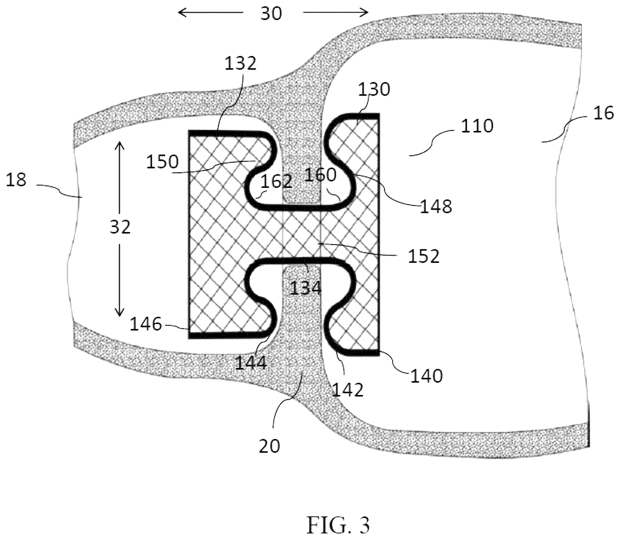 Patent US12599469 Figure 3 – Systems and methods for anchoring and restraining gastrointestinal prostheses