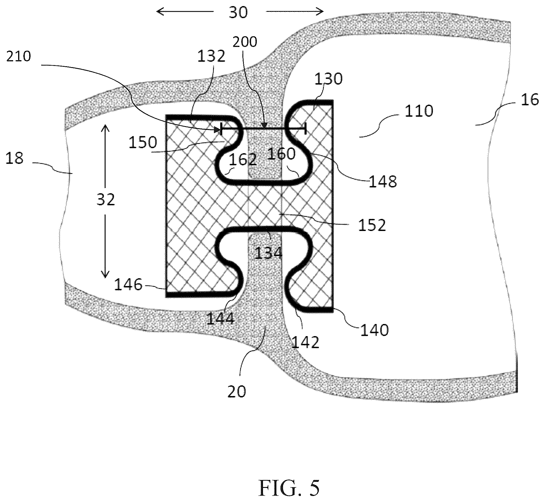 Patent US12599469 Figure 5 – Systems and methods for anchoring and restraining gastrointestinal prostheses