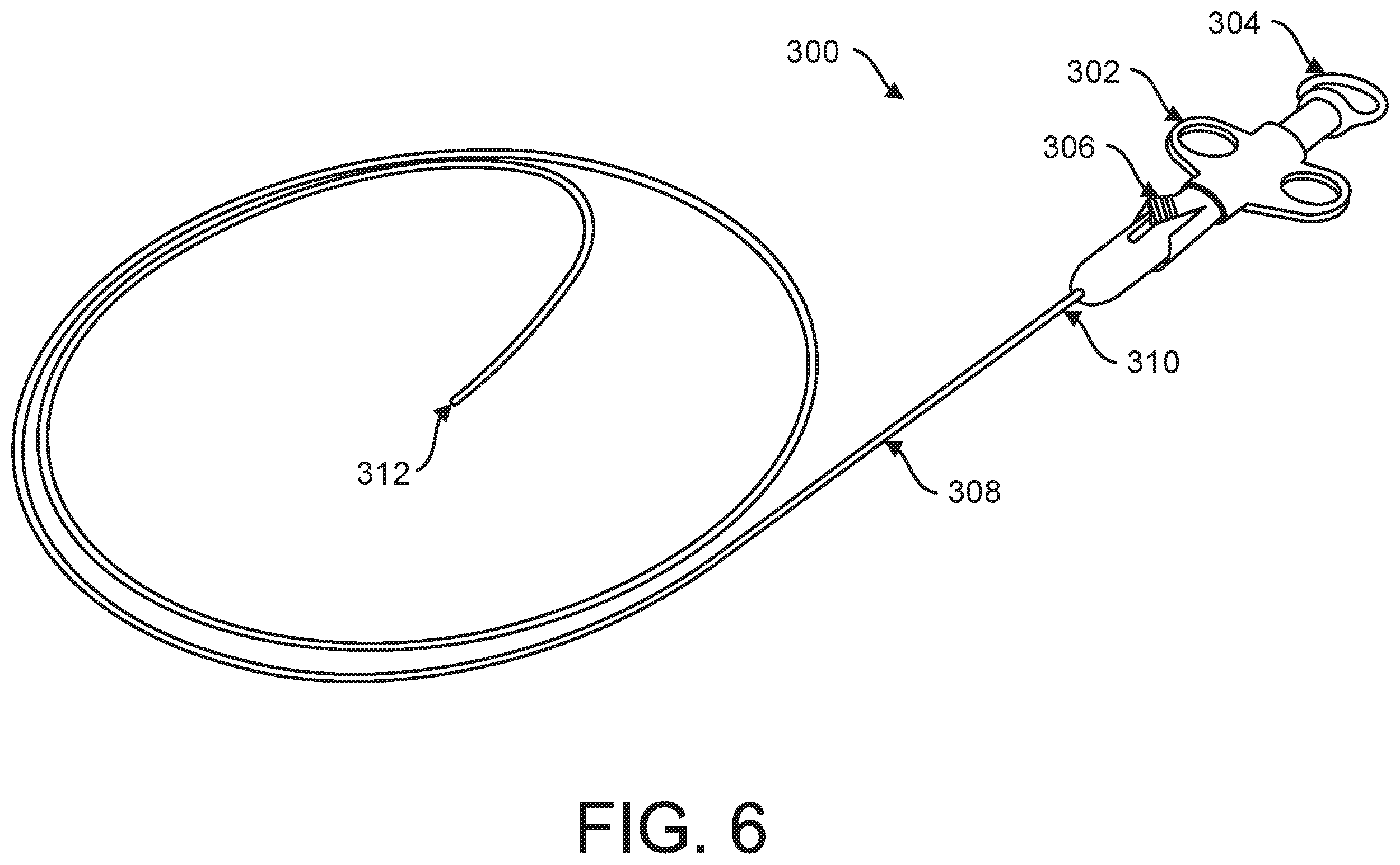 Patent US12599469 Figure 6 – Systems and methods for anchoring and restraining gastrointestinal prostheses