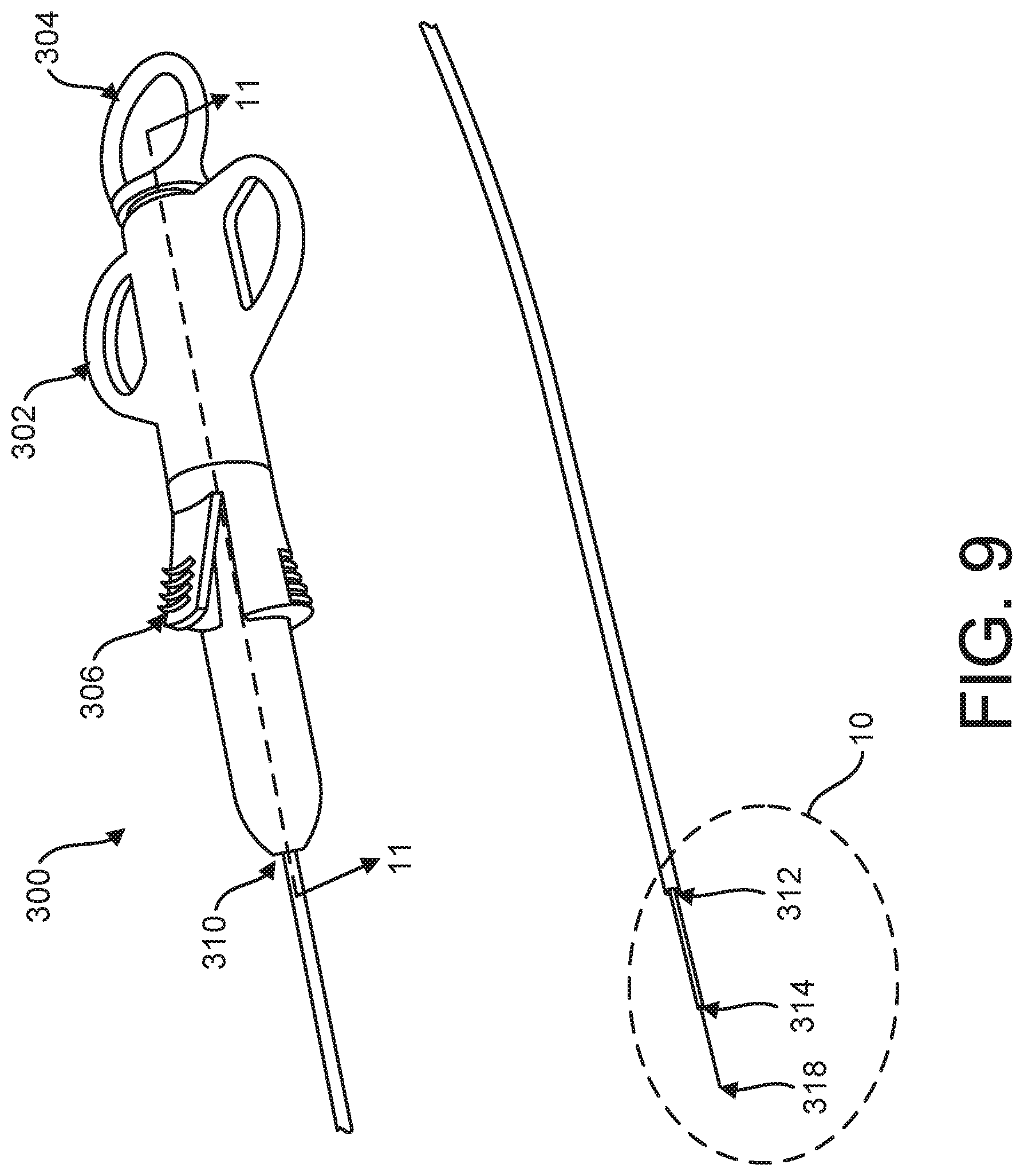 Patent US12599469 Figure 9 – Systems and methods for anchoring and restraining gastrointestinal prostheses