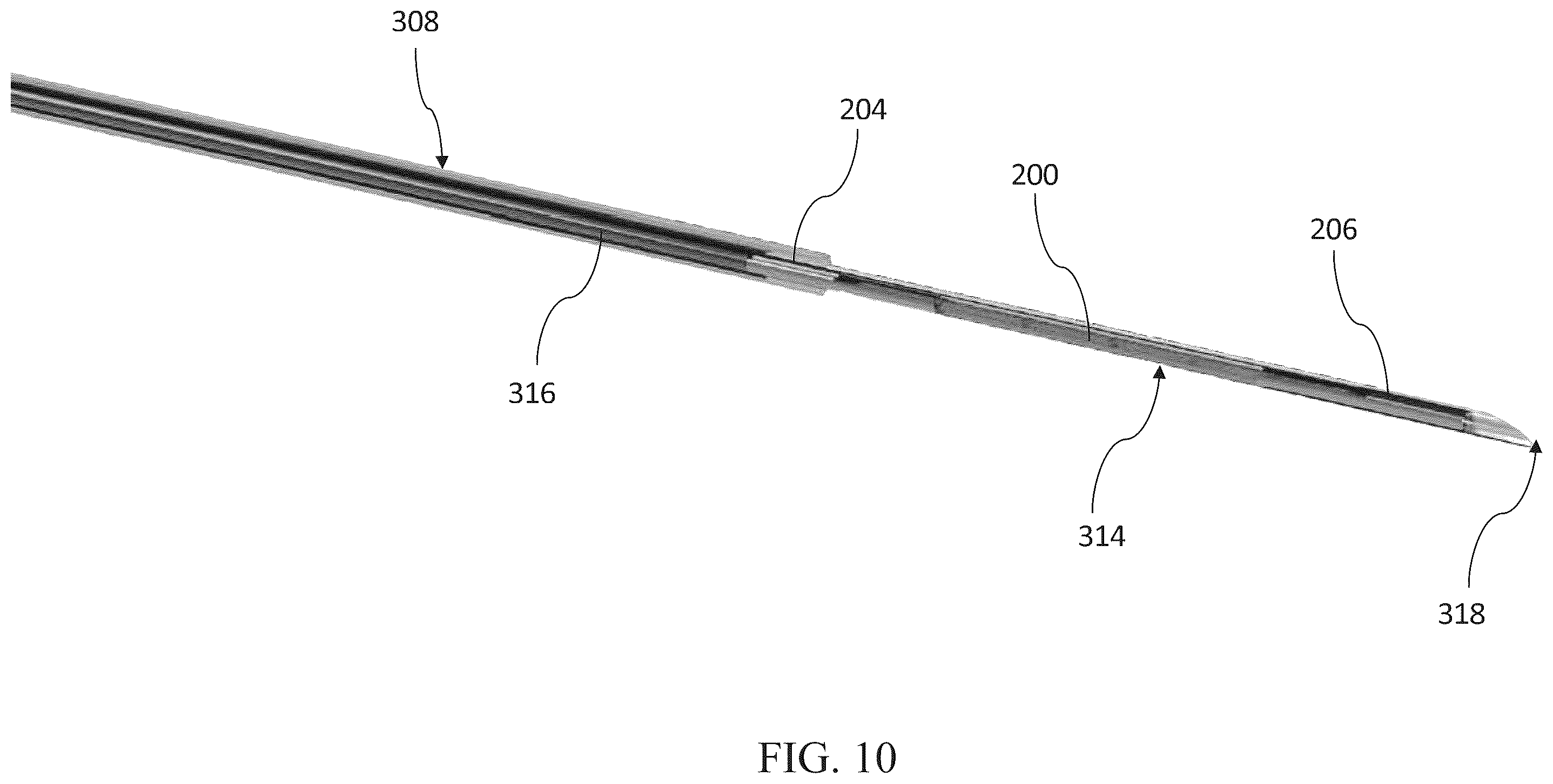 Patent US12599469 Figure 10 – Systems and methods for anchoring and restraining gastrointestinal prostheses