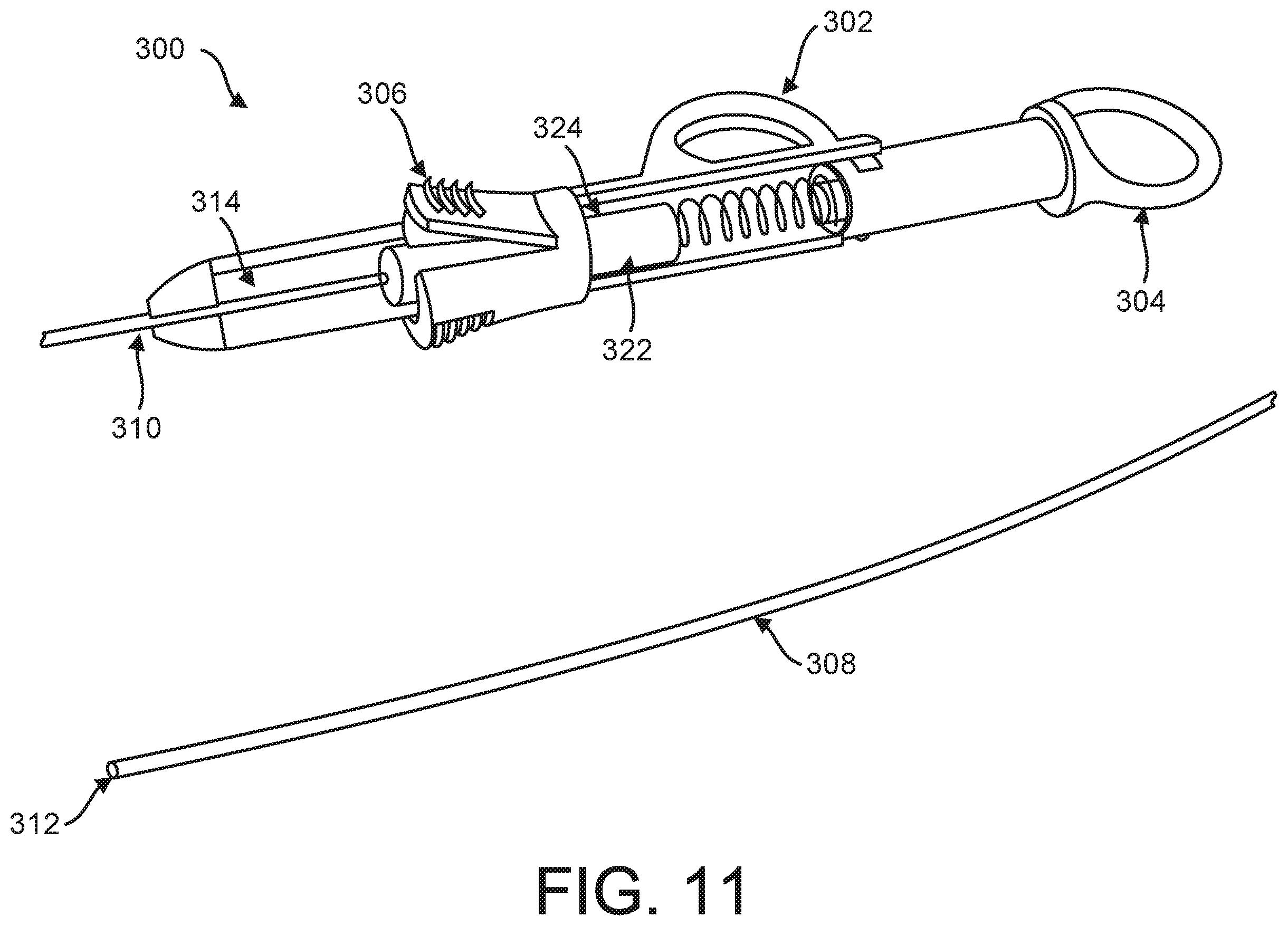 Patent US12599469 Figure 11 – Systems and methods for anchoring and restraining gastrointestinal prostheses