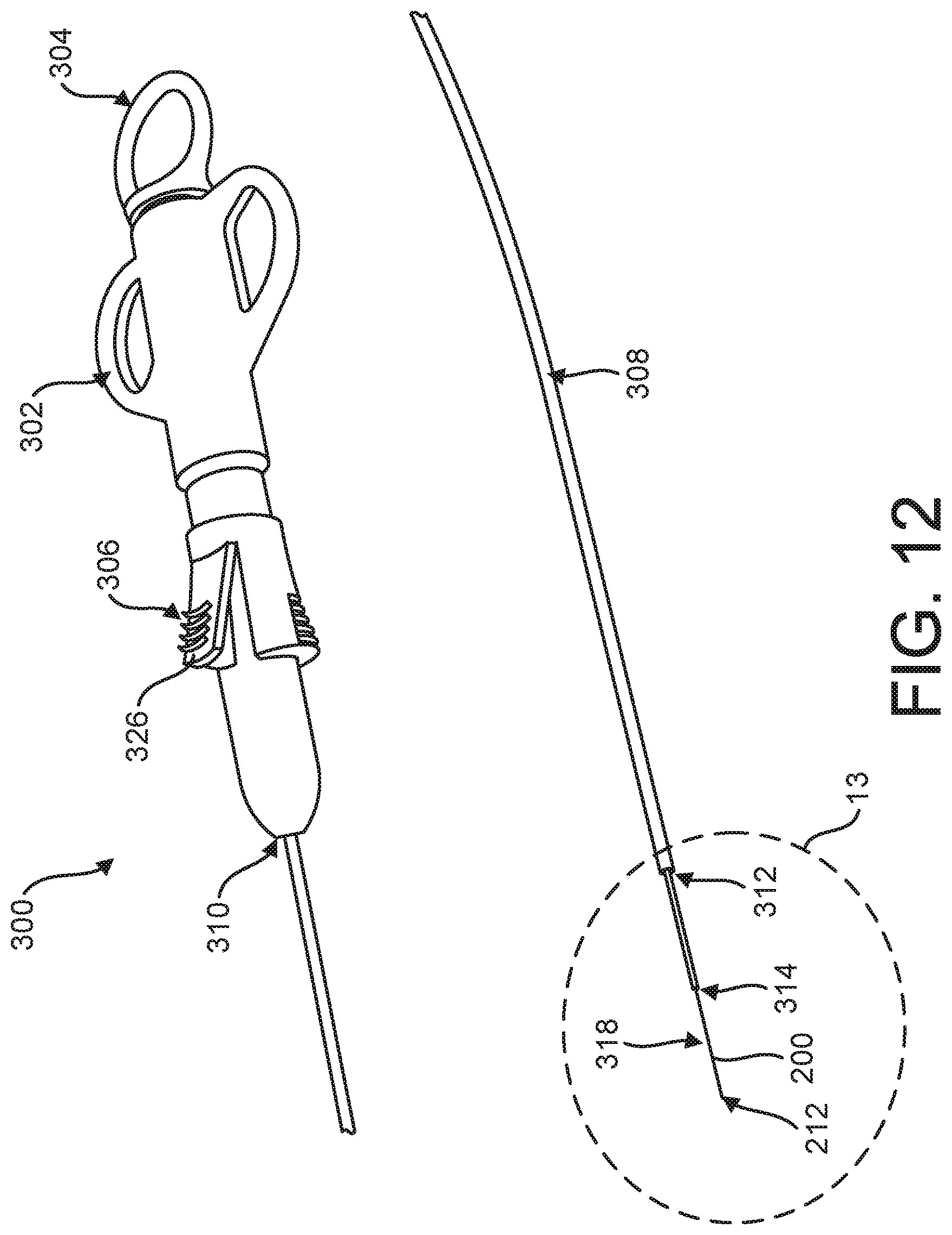 Patent US12599469 Figure 12 – Systems and methods for anchoring and restraining gastrointestinal prostheses