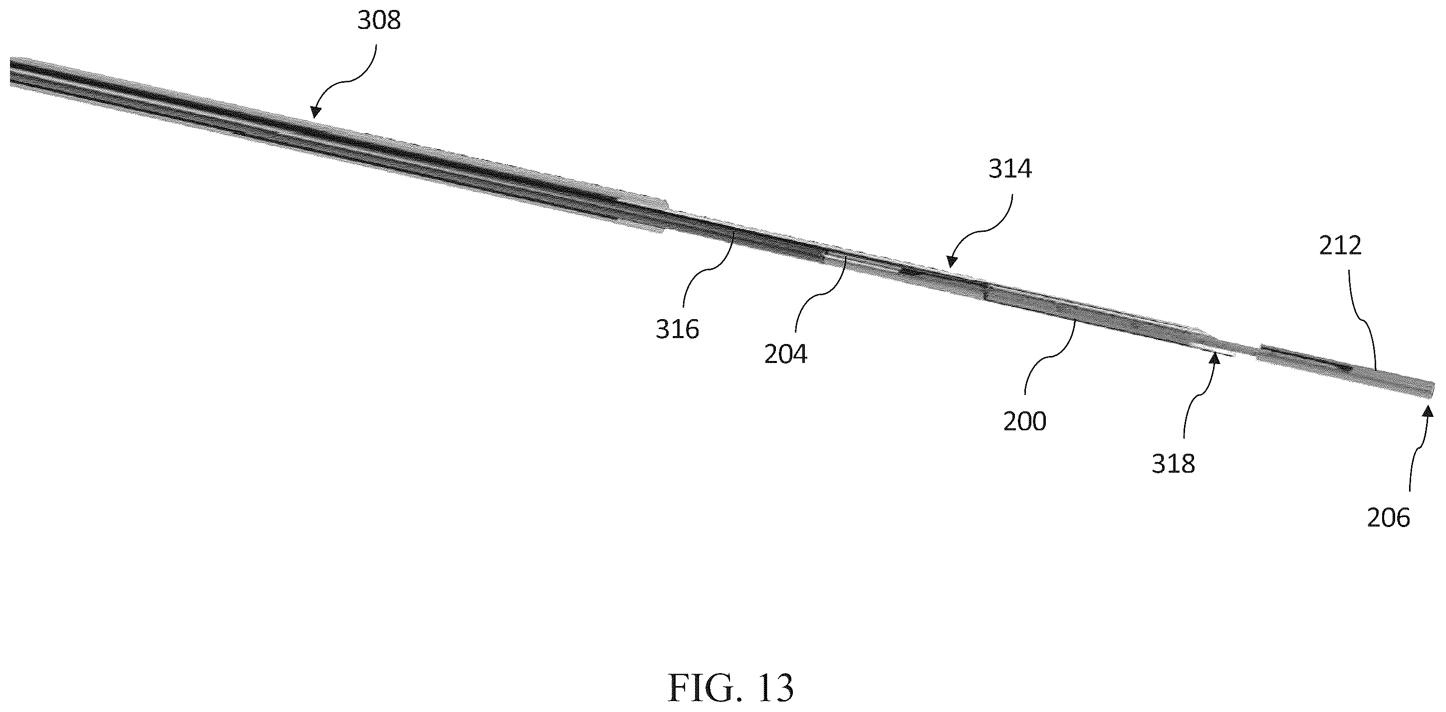 Patent US12599469 Figure 13 – Systems and methods for anchoring and restraining gastrointestinal prostheses