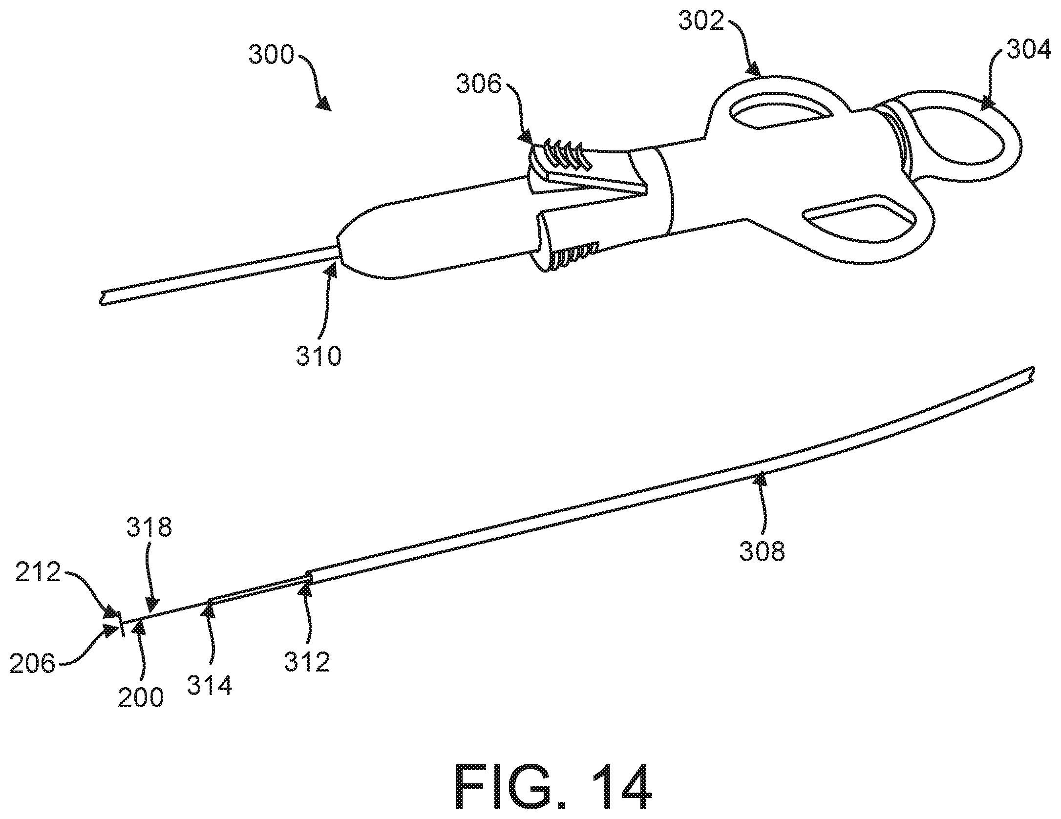 Patent US12599469 Figure 14 – Systems and methods for anchoring and restraining gastrointestinal prostheses