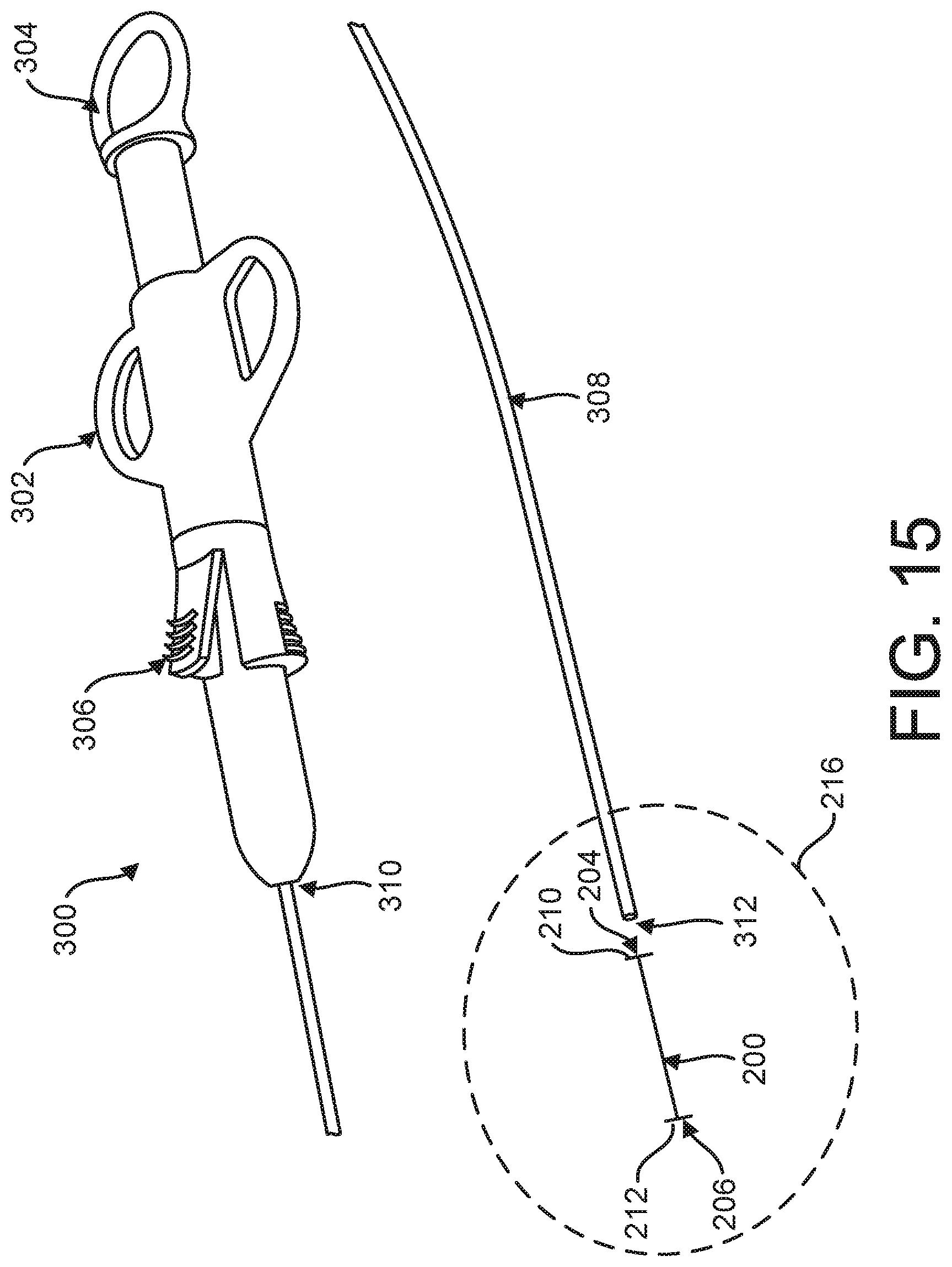 Patent US12599469 Figure 15 – Systems and methods for anchoring and restraining gastrointestinal prostheses