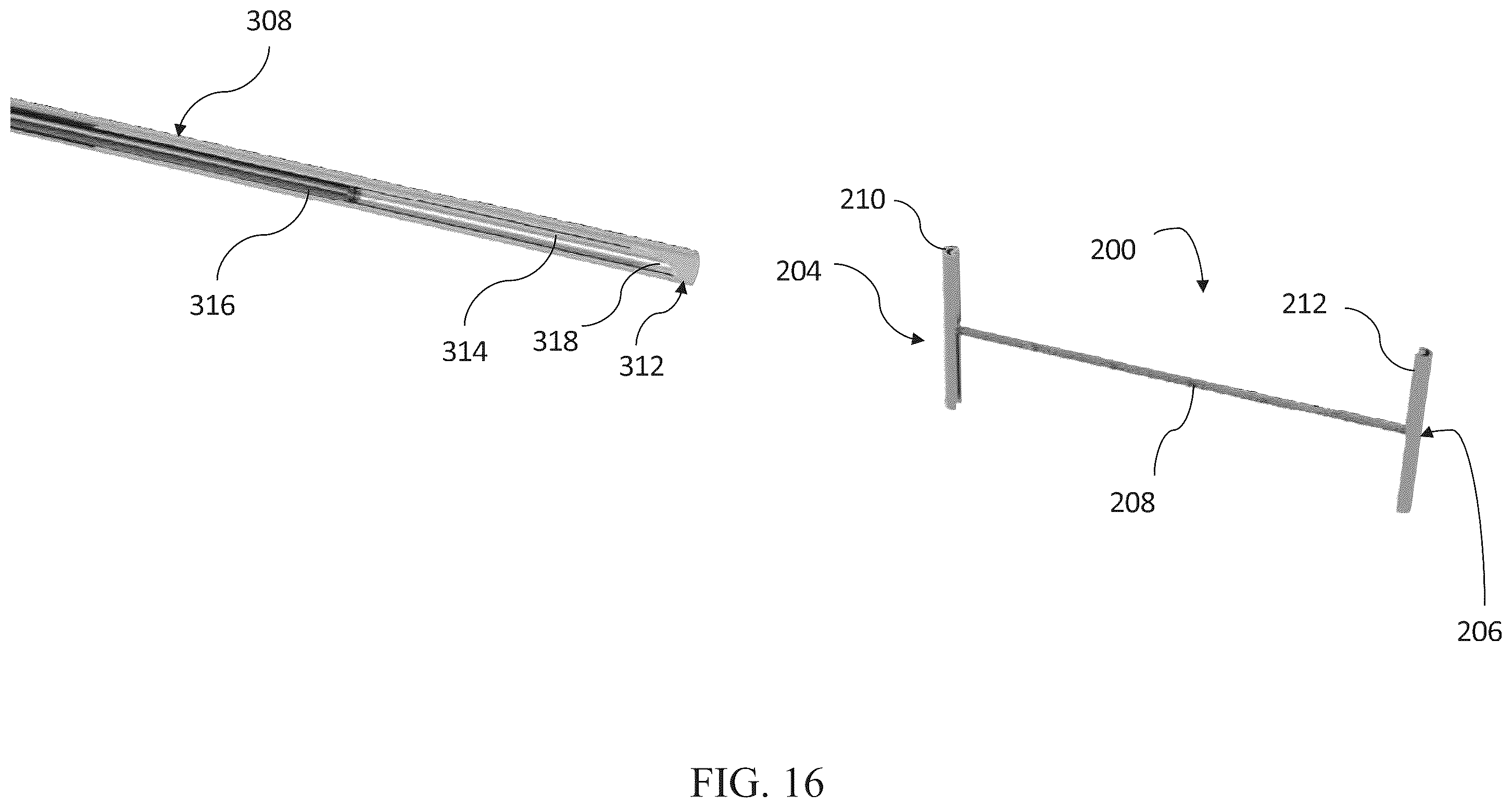 Patent US12599469 Figure 16 – Systems and methods for anchoring and restraining gastrointestinal prostheses