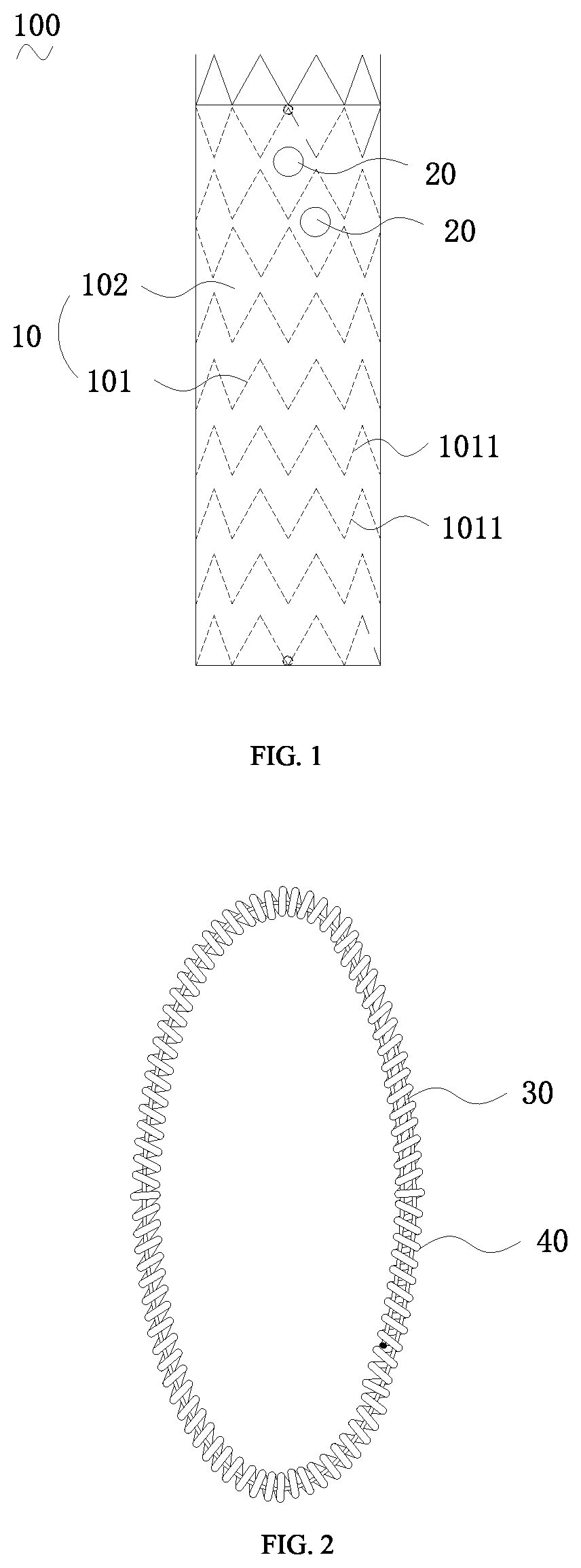 Patent US12599472 — Covered stent — Figure 1