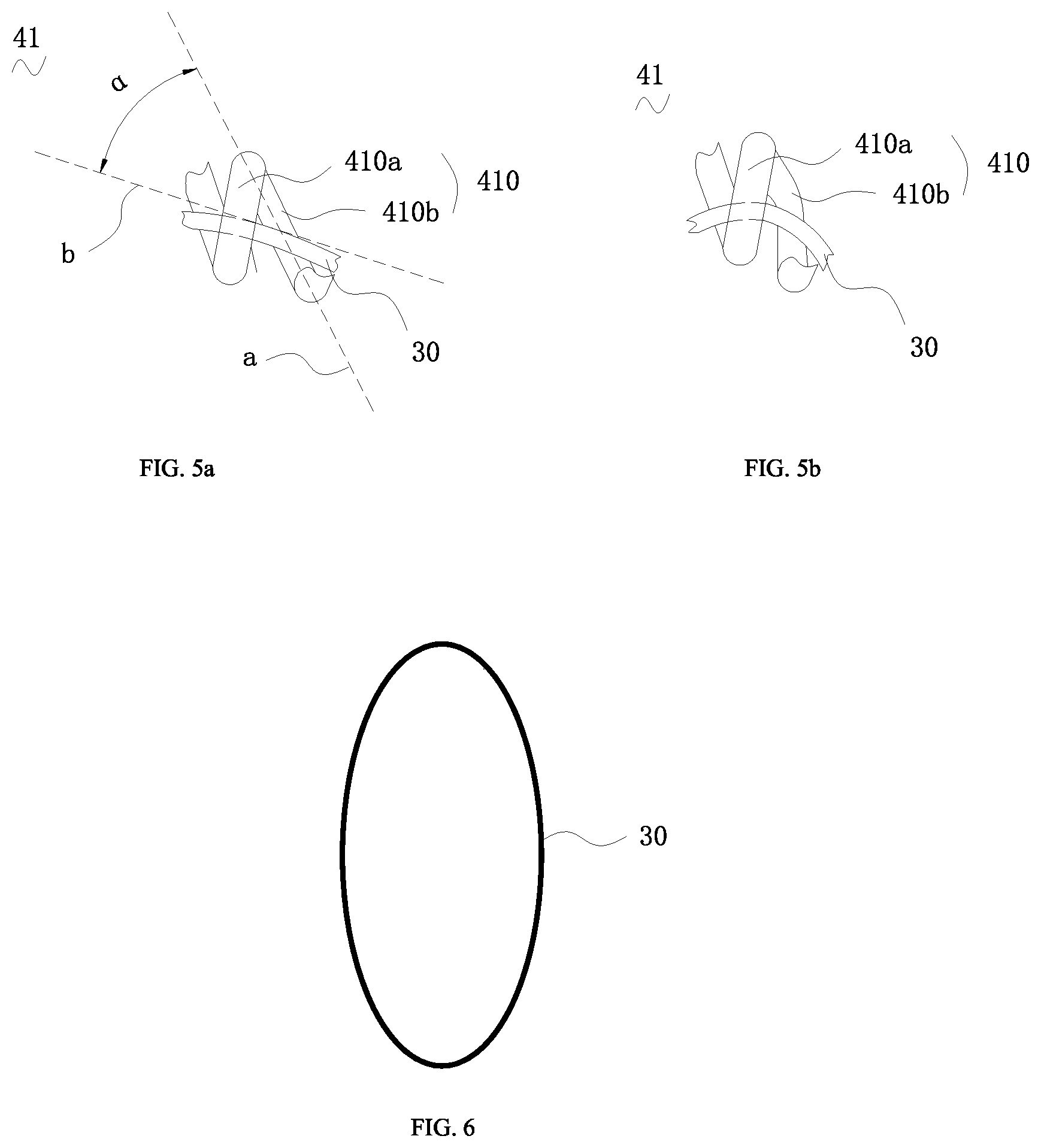 Patent US12599472 Figure 3 – Covered stent
