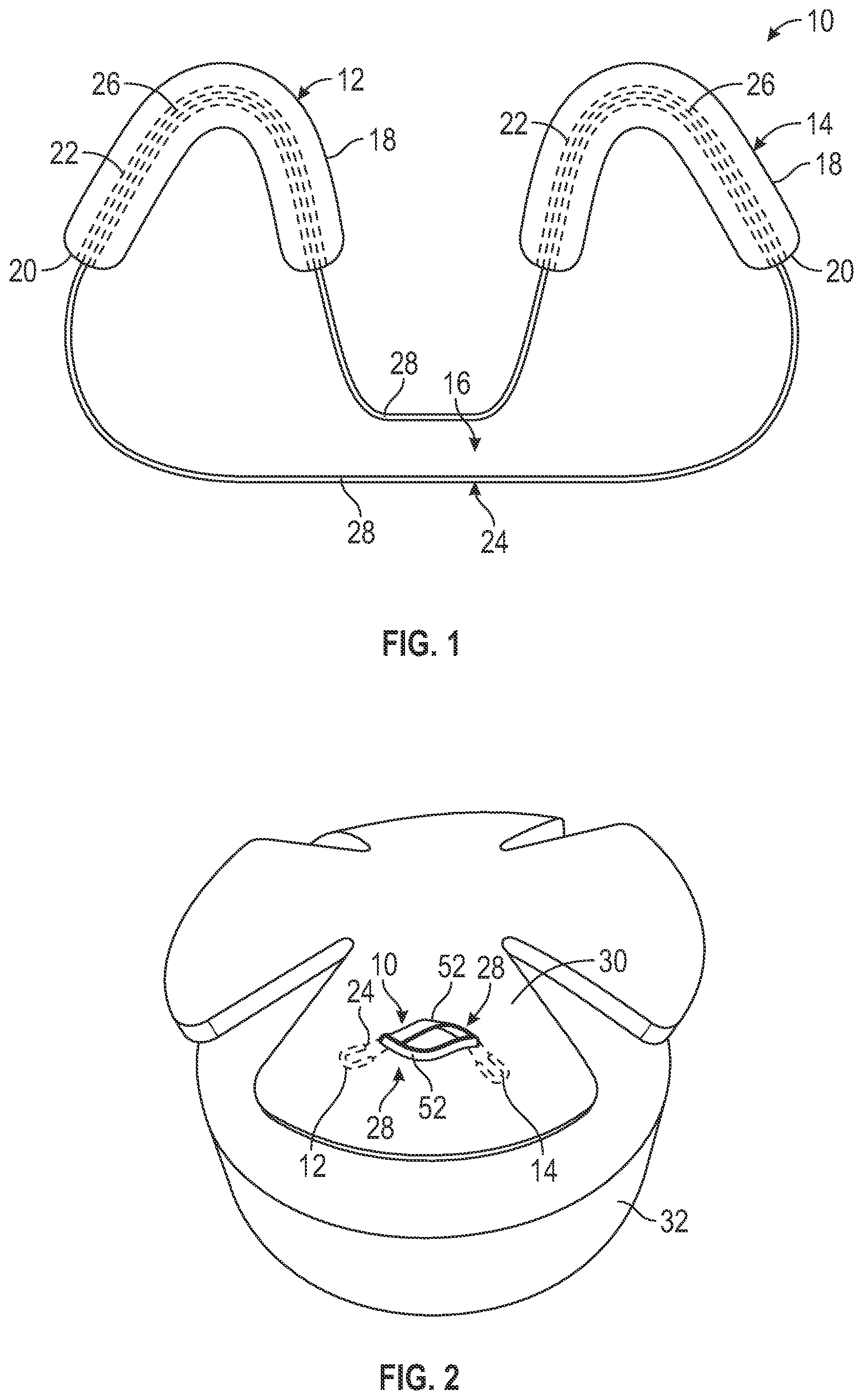 Patent US12599473 Figure 1 – Tensionable knotless tissue repair systems and surgical methods