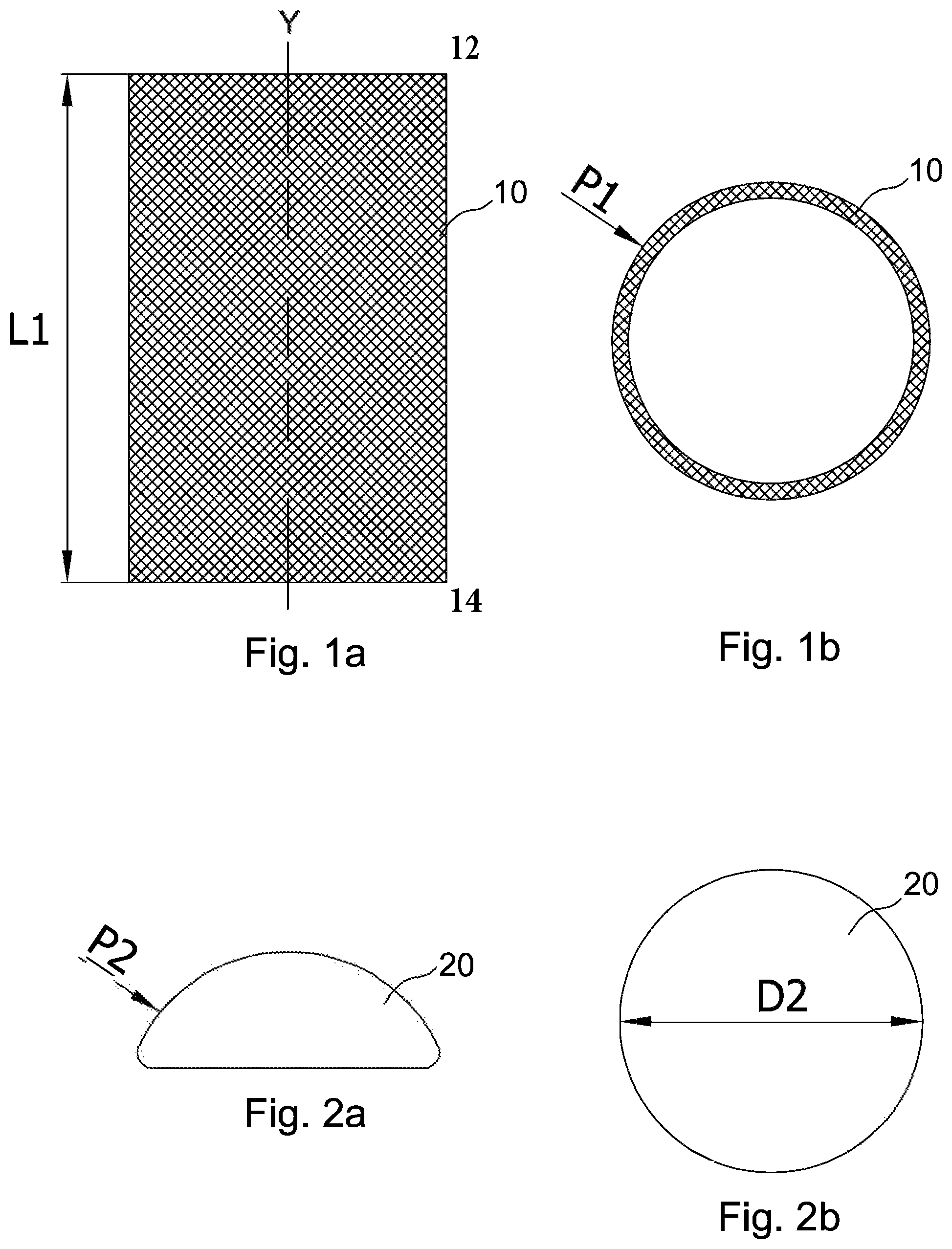 Patent US12599474 Figure 1 – Tubular mesh support device for a breast implant and method for preparing the breast implant