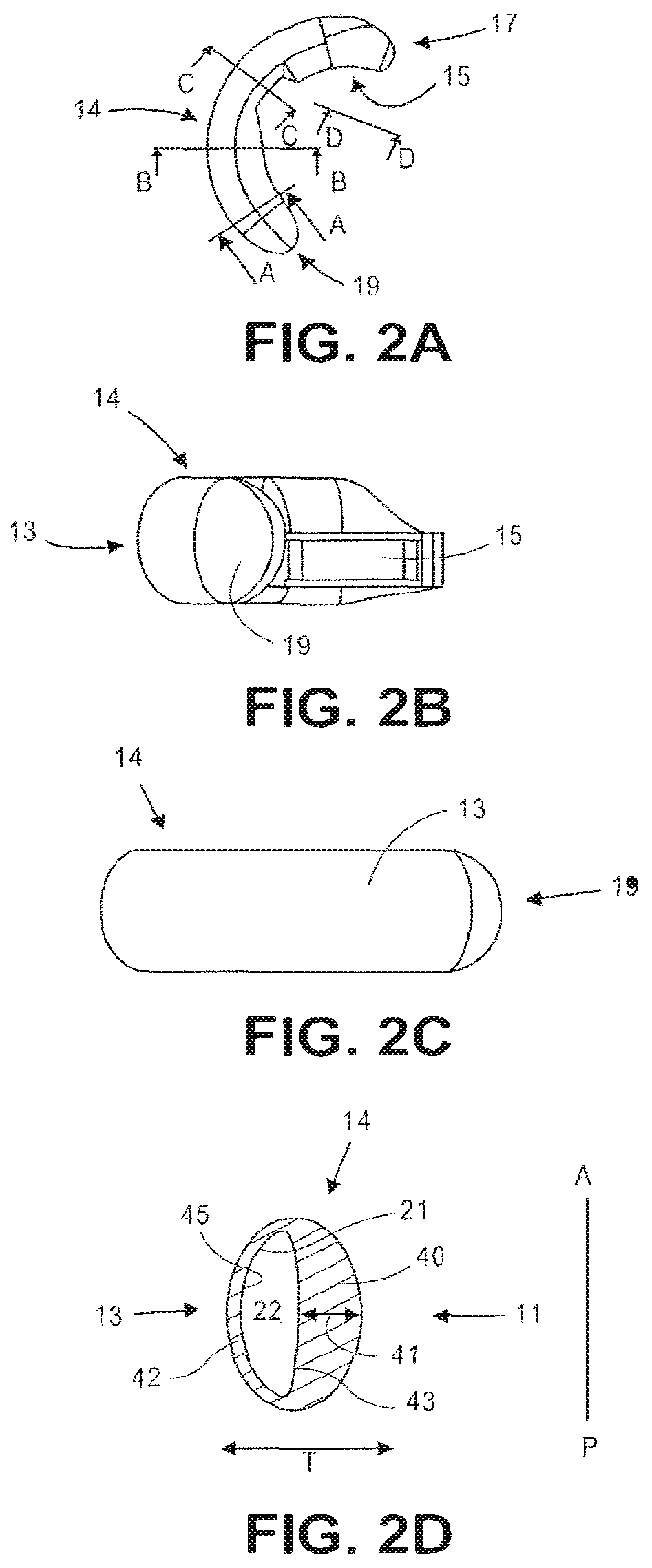 Patent US12599475 Figure 4 – Accommodating intraocular lenses and methods of manufacturing