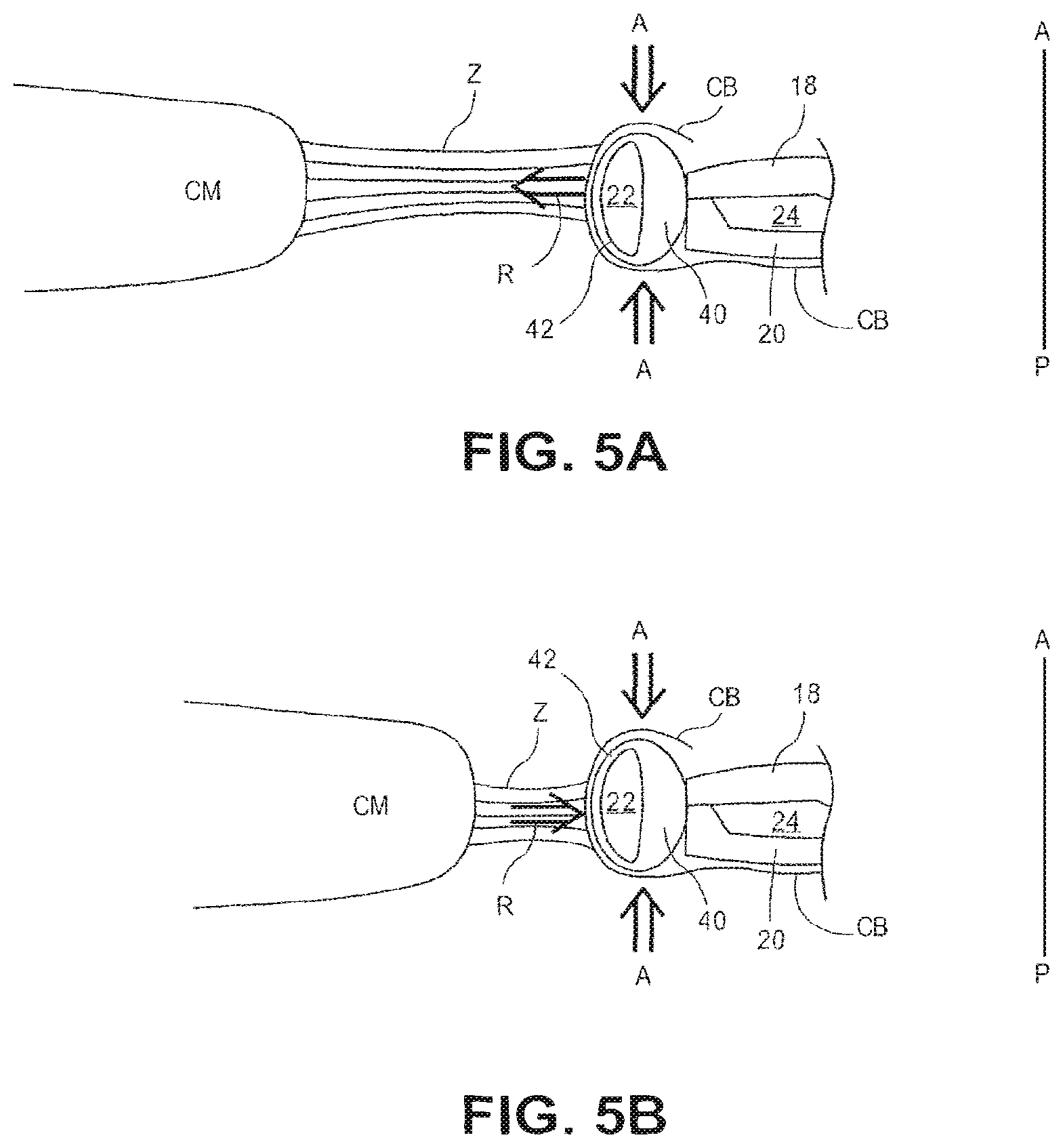 Patent US12599475 Figure 7 – Accommodating intraocular lenses and methods of manufacturing