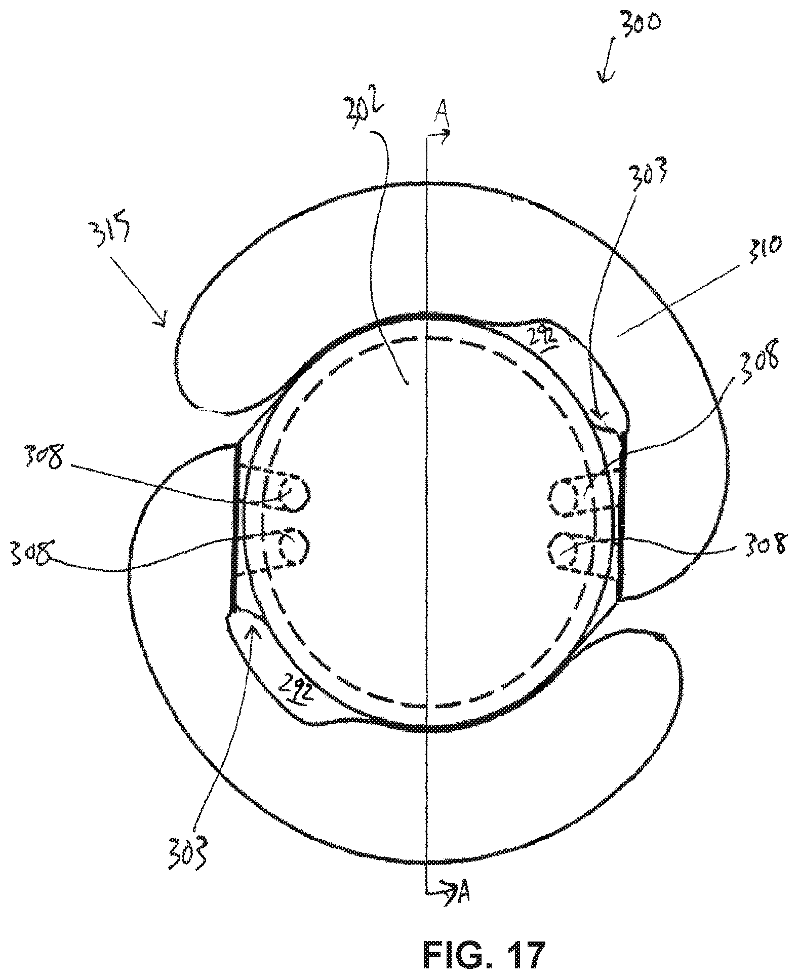 Patent US12599475 Figure 17 – Accommodating intraocular lenses and methods of manufacturing