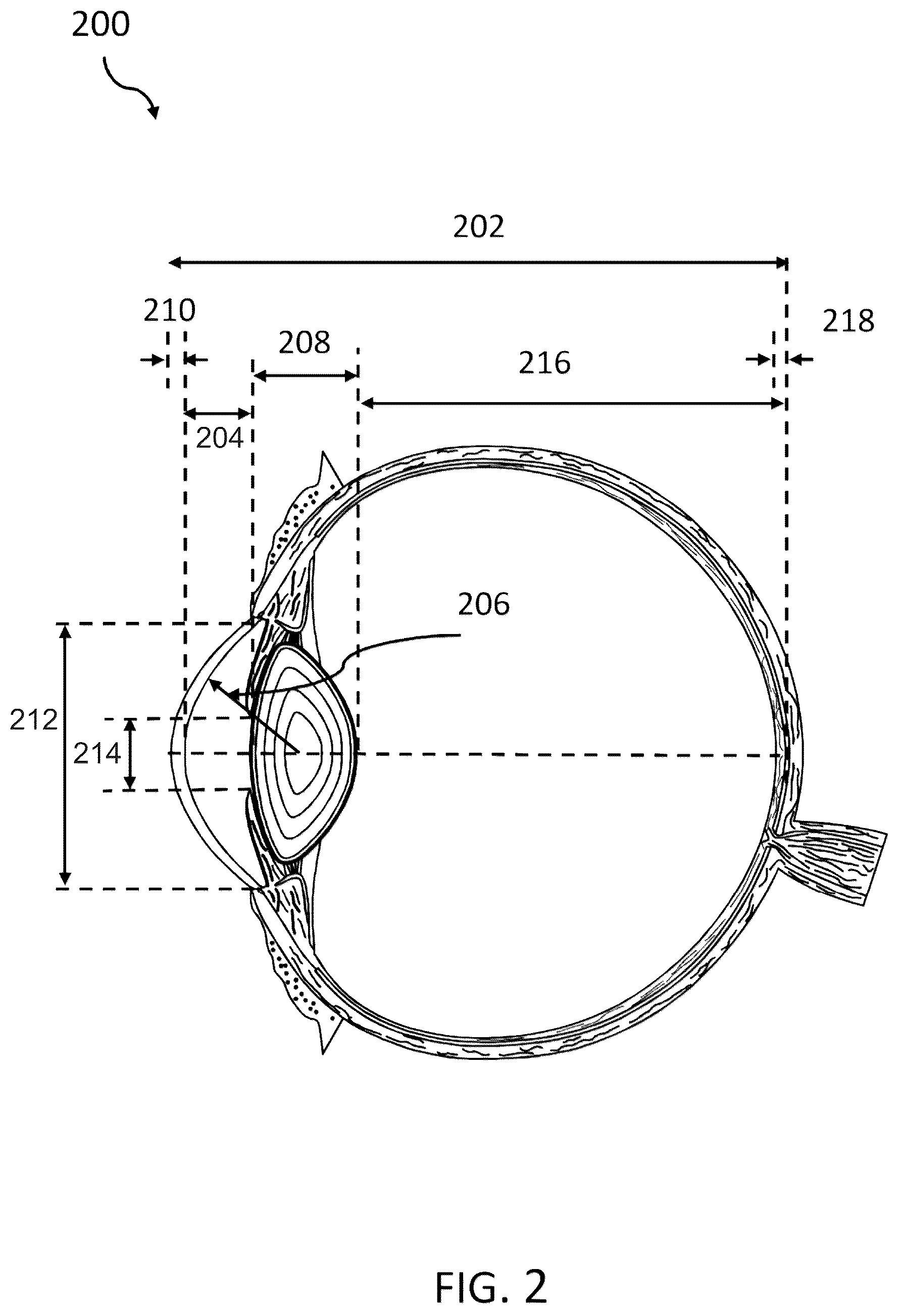 Patent US12599476 Figure 2 – AI-based video analysis of cataract surgery for dynamic anomaly recognition and correction