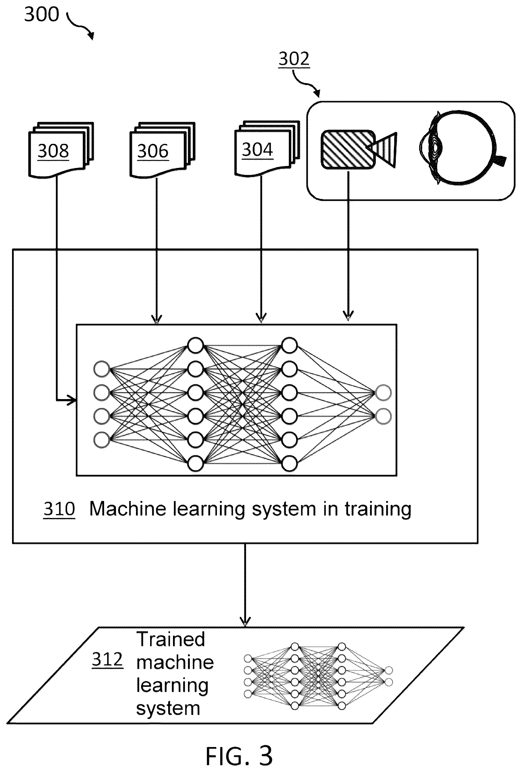 Patent US12599476 Figure 3 – AI-based video analysis of cataract surgery for dynamic anomaly recognition and correction