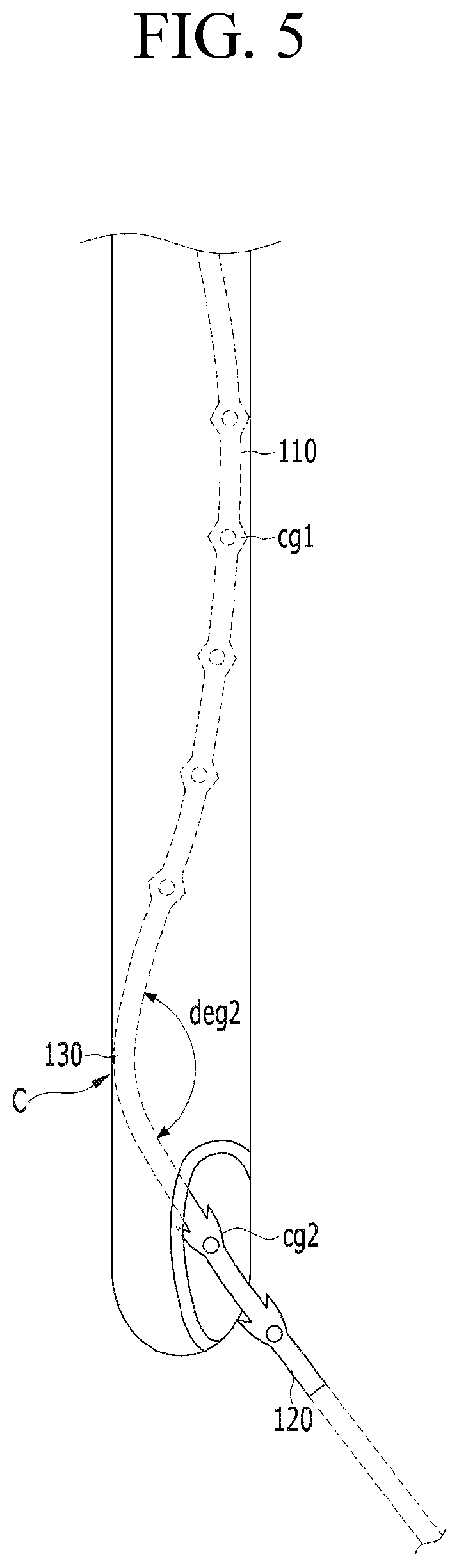 Patent US12599478 Figure 5 – Lifting suture for rhinoplasty and manufacturing method thereof