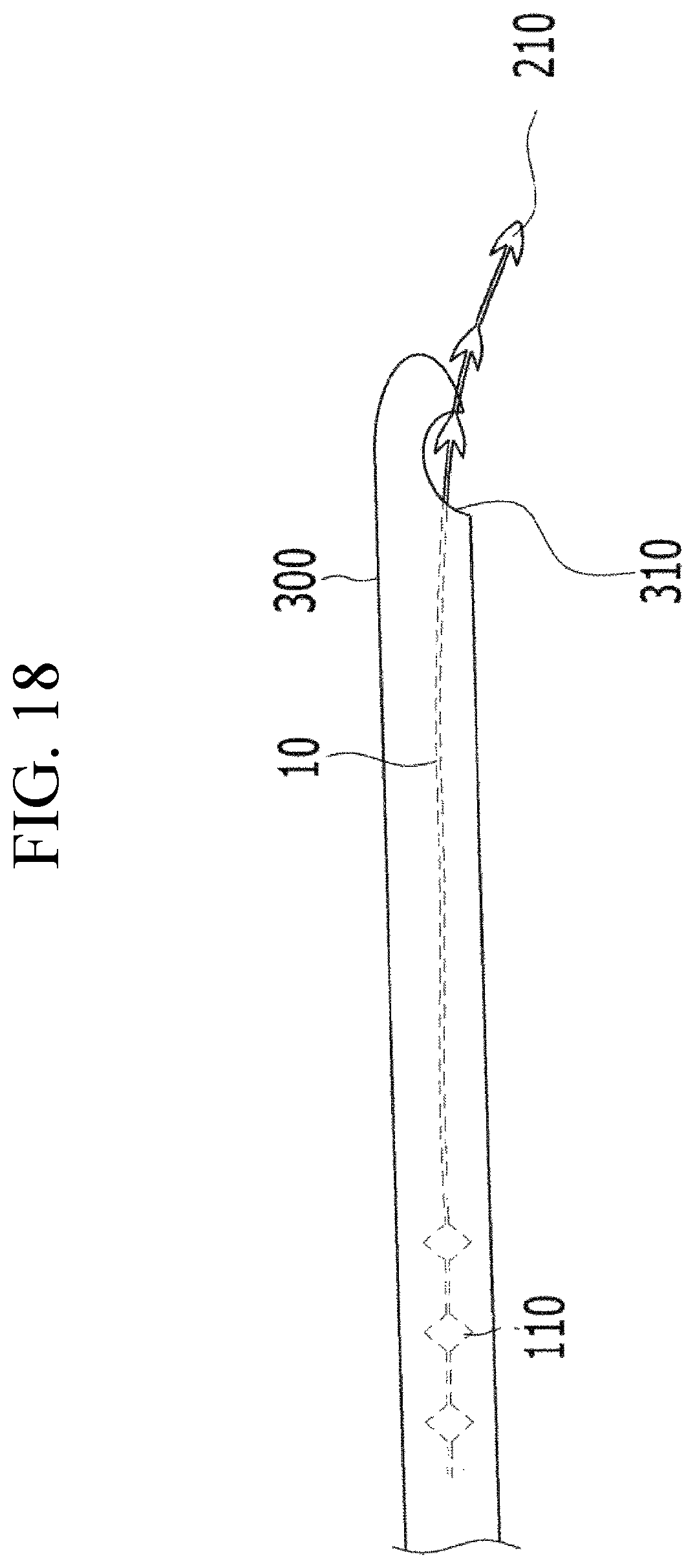 Patent US12599478 Figure 17 – Lifting suture for rhinoplasty and manufacturing method thereof