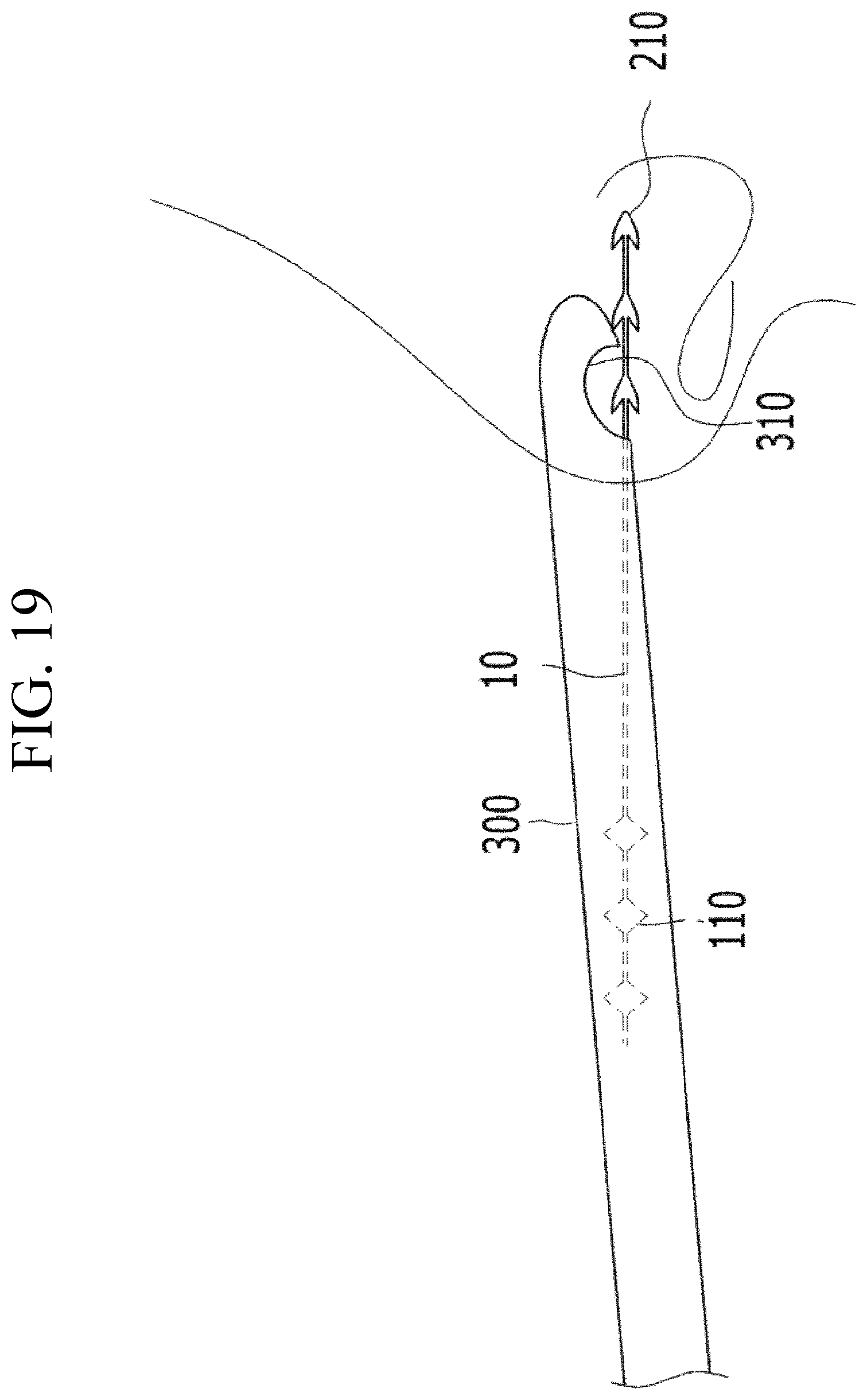 Patent US12599478 Figure 18 – Lifting suture for rhinoplasty and manufacturing method thereof