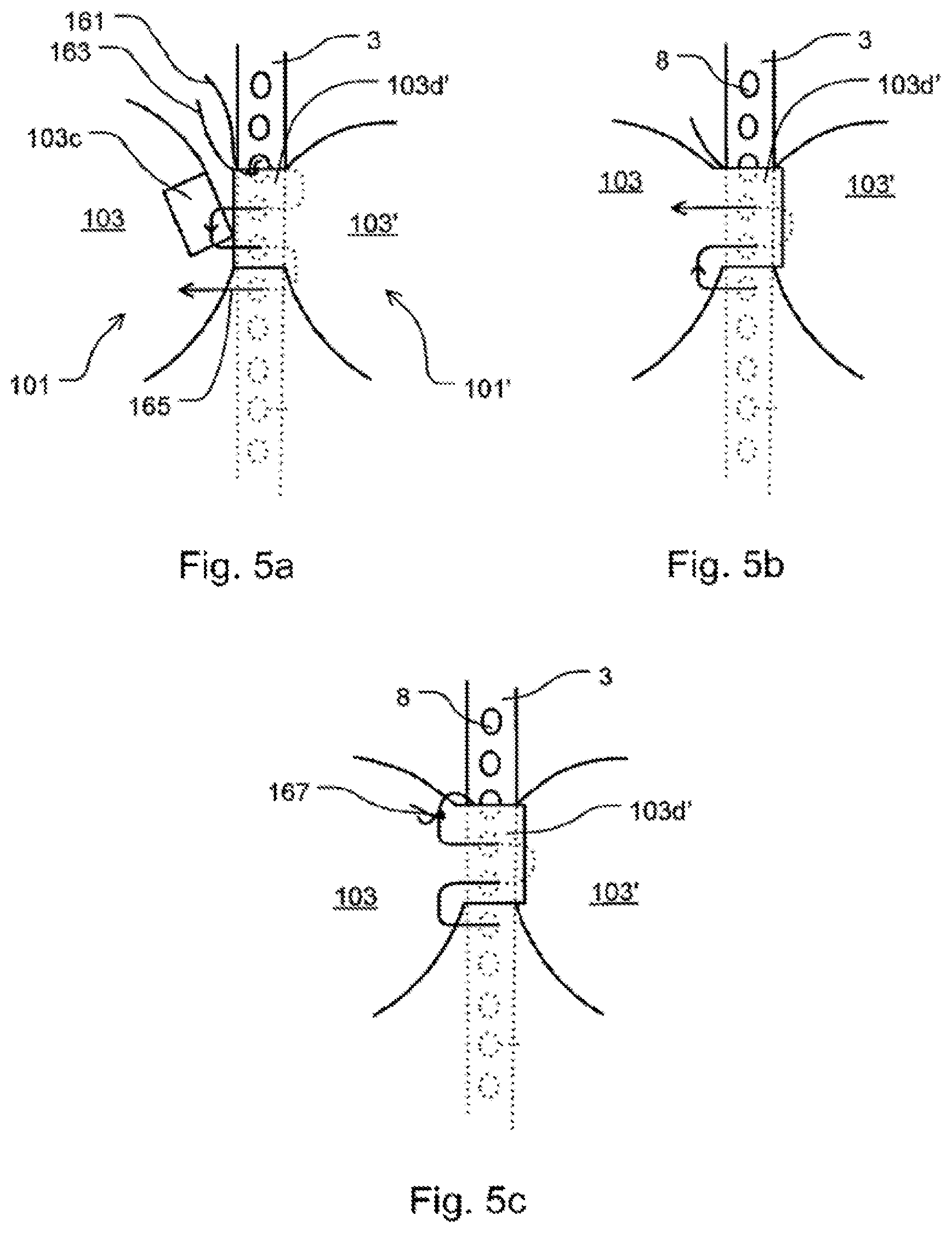 Patent US12599479 Figure 3 – Heart valve comprising a crown piece interconnected to leaflets, a top cuff and a bottom cuff; and a medical implant
