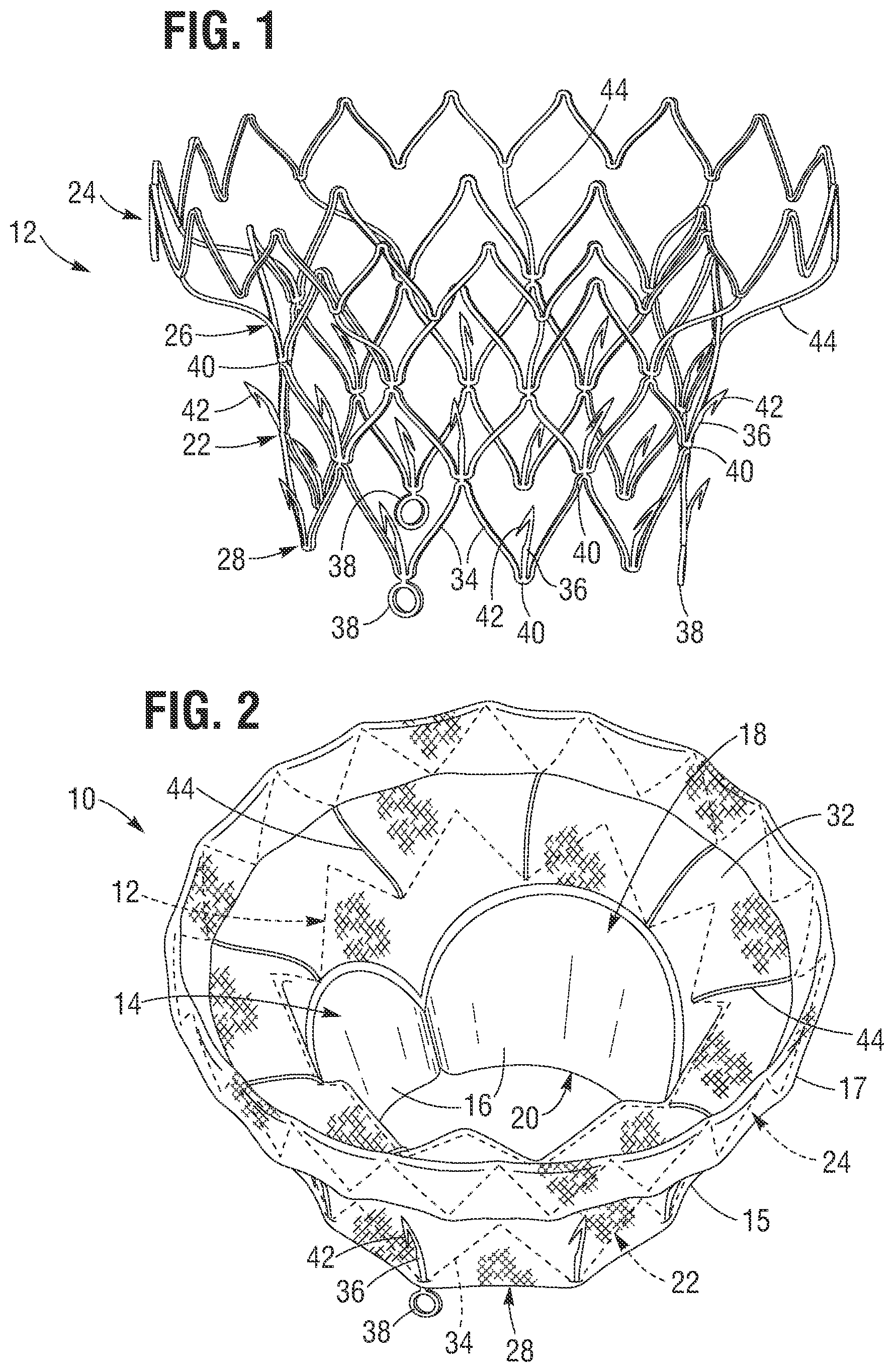 Patent US12599480 Figure 1 – Percutaneous mitral valve replacement device