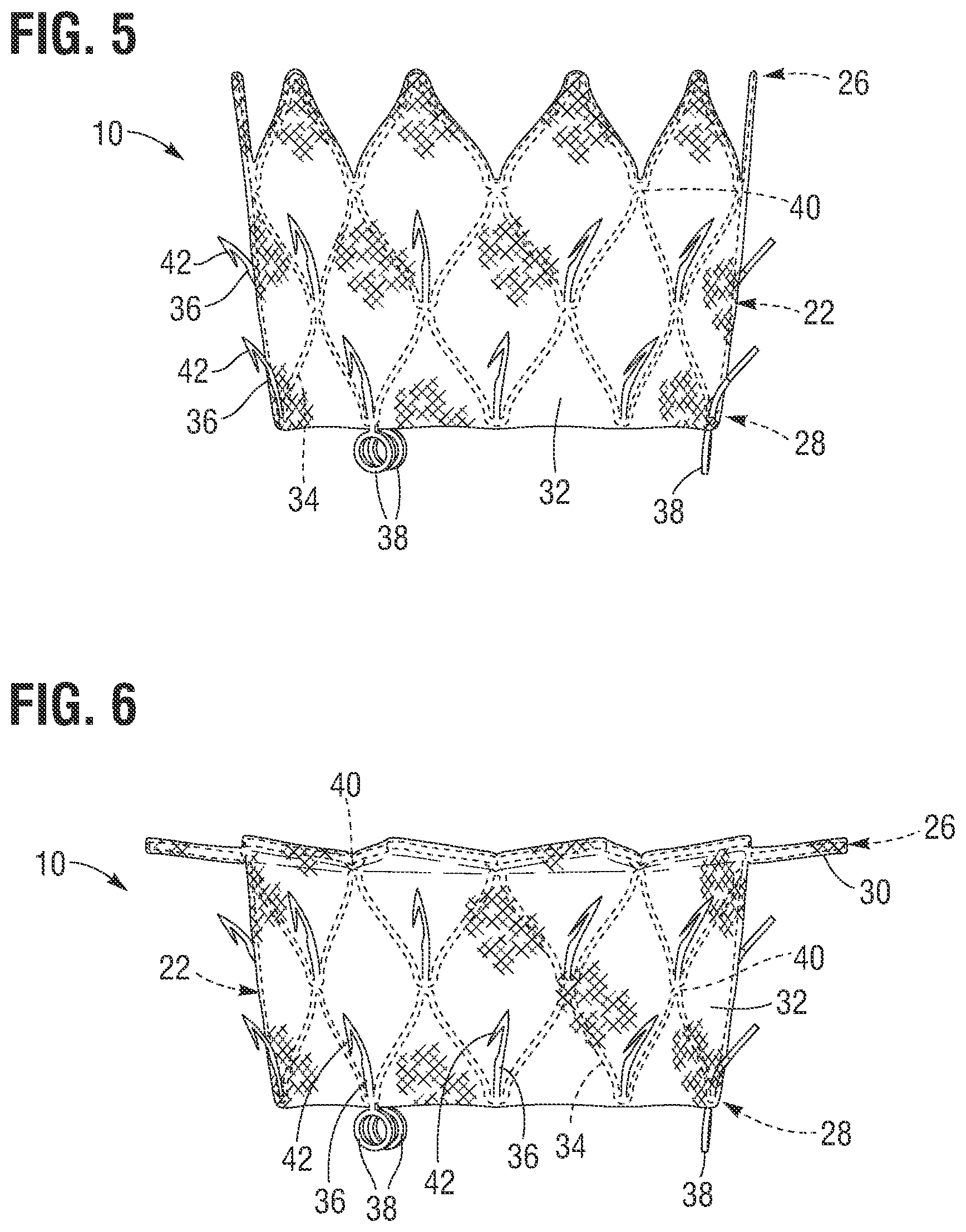 Patent US12599480 Figure 3 – Percutaneous mitral valve replacement device