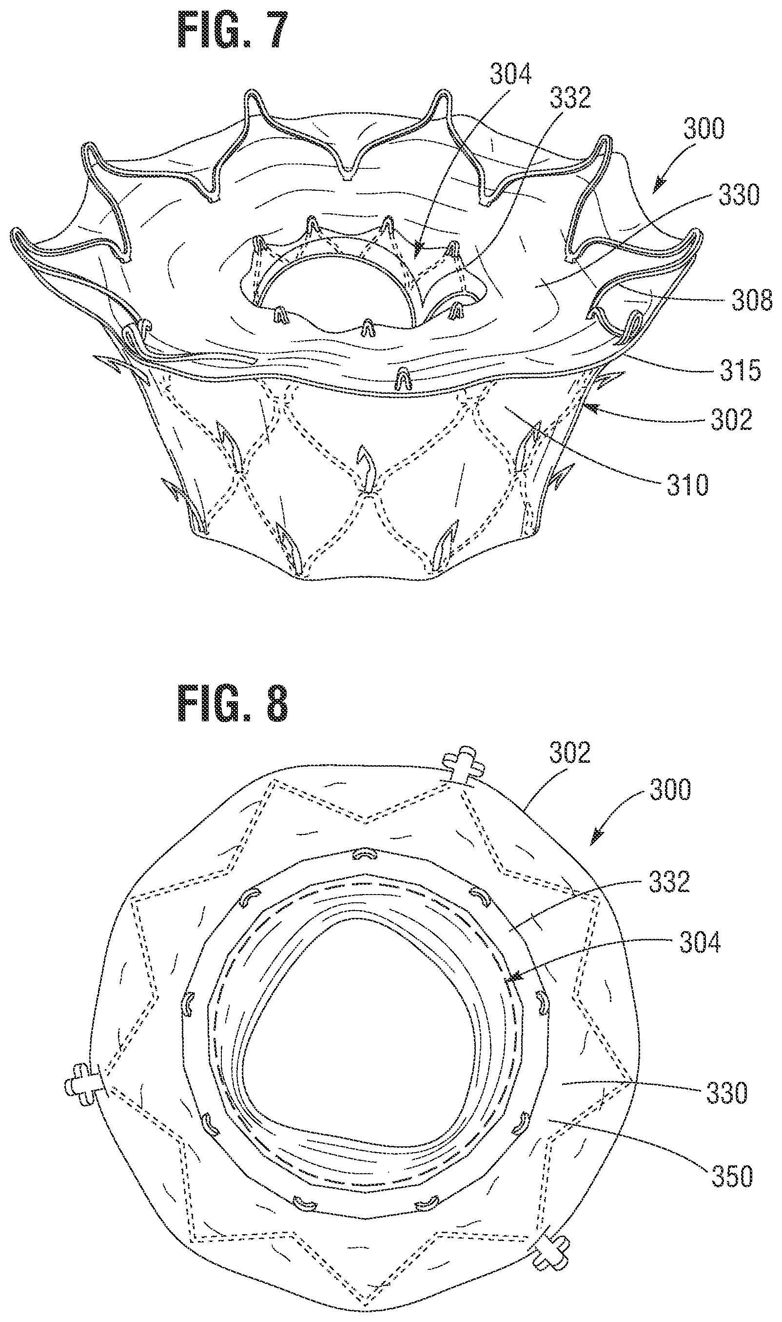 Patent US12599480 Figure 4 – Percutaneous mitral valve replacement device