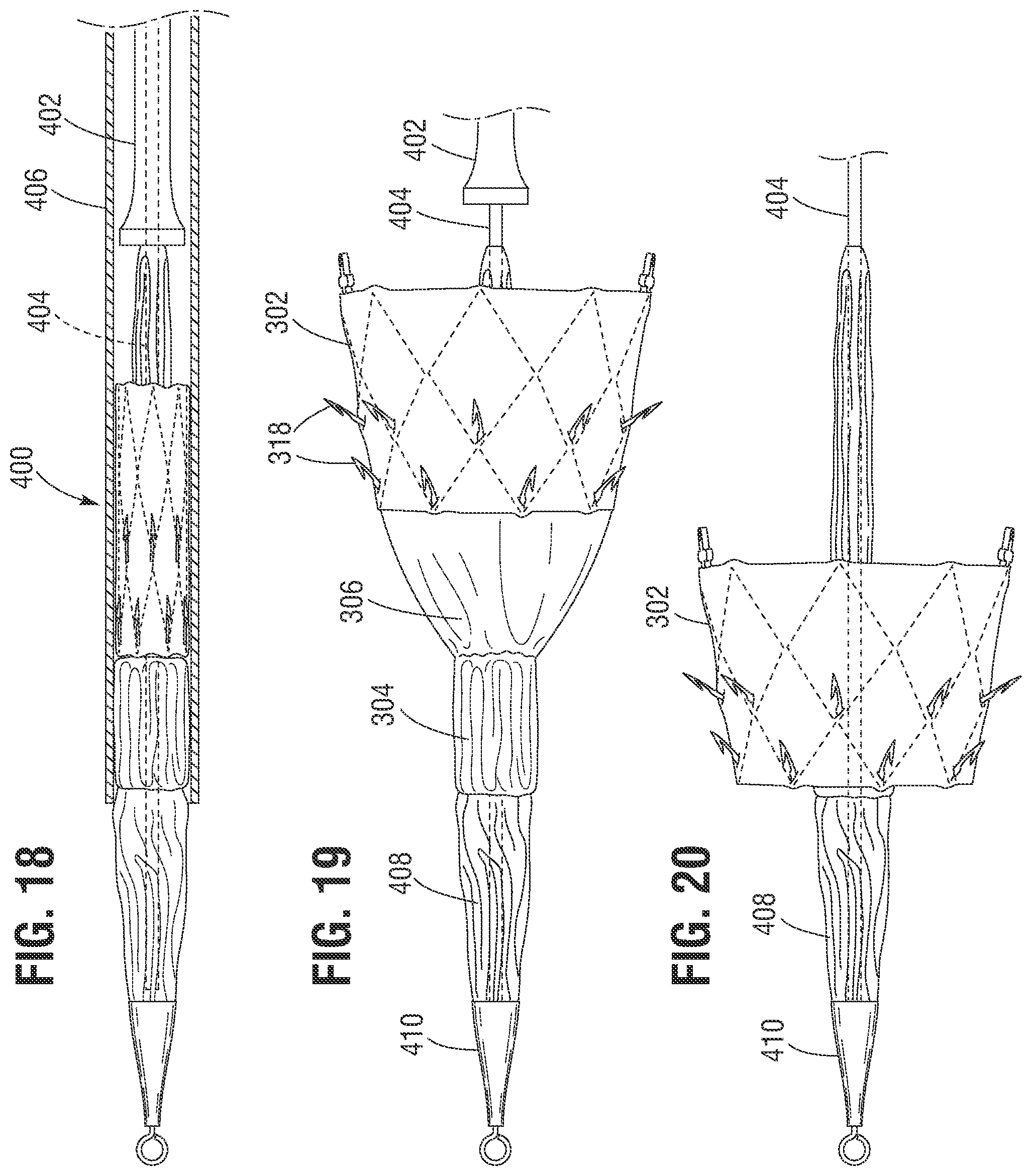 Patent US12599480 Figure 9 – Percutaneous mitral valve replacement device